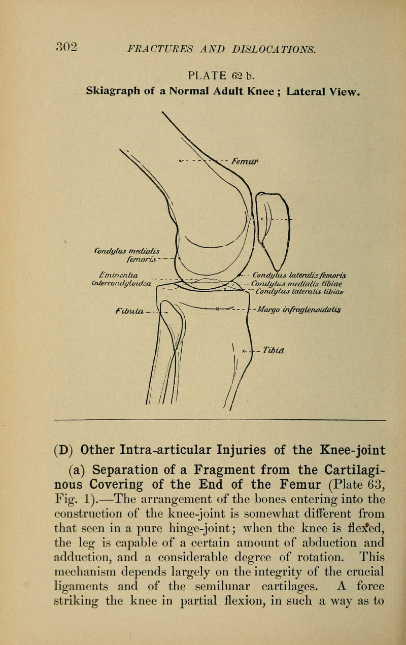 PLATE 62 b. Skiagraph of a Normal Adult Knee ; Lateral View. Femilr CondyUis mediaUs femorts — fnuncnlui CnlercoiidyioLdea Fidula CoadyUus UUeraUs fkmorisi ;i^-- Condytus medialis tibiae *^=^^ CondyCus lateraiis tibixie Margo infraglefwidalis (D) Other Intra-articular Injuries of the Knee-joint (a) Separation of a Fragment from the Cartilagi- nous Covering of the End of the Femur (Plate 63, Fig. 1).—The arrangement of the bones entering into the construction of the knee-joint is somewhat diiferent from that seen in a pure hinge-joint; when the knee is fle:5?ed, the leg is capable of a certain amount of abduction and adduction, and a considerable degree of rotation. This mechanism depends largely on the integrity of the crucial ligaments and of the semilunar cartilages. A force striking the knee in partial flexion, in such a way as to