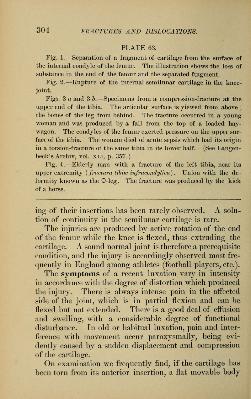 PLATE 63. Fig. 1.—Separation of a fragment of cartilage from the surface of the internal condyle of the femur. The illustration shows the loss of substance in the end of the femur and the separated fragment. Fig. 2.—Rupture of the internal semilunar cartilage in the knee- joint. Figs. 3 a and 3 b.—Specimens from a compression-fracture at the upper end of the tibia. The articular surface is viewed from above ; the bones of the leg from behind. The fracture occurred in a young woman and was produced by a fall from the top of a loaded hay- wagon. The condyles of the femur exerted pressure on the upper sur- face of the tibia. The woman died of acute sepsis which had its origin in a torsion-fracture of the same tibia in its lower half. (See Langen- beck's Archiv, vol. xli, p. 357.) Fig. 4.—Elderly man with a fracture of the left tibia, near its upper extremity {fractura tibiae infracondylica). Union with the de- formity known as the 0-leg. The fracture was produced by the kick of a horse. ing of their insertions has been rarely observed. A solu- tion of continuity in the semilunar cartilage is rare. The injuries are produced by active rotation of the end of the femur while the knee is flexed, thus extruding the cartilage. A sound normal joint is therefore a prerequisite condition, and the injury is accordingly observed most fre- quently in England among athletes (football players, etc.). The symptoms of a recent luxation vary in intensity in accordance with the degree of distortion which produced the injury. There is always intense pain in the affected side of the joint, which is in partial flexion and can be flexed but not extended. There is a good deal of effusion and swelling, with a considerable degree of functional disturbance. In old or habitual luxation, pain and inter- ference with movement occur paroxysmally, being evi- dently caused by a sudden displacement and compression of the cartilage. On examination we frequently find, if the cartilage has been torn from its anterior insertion, a flat movable body