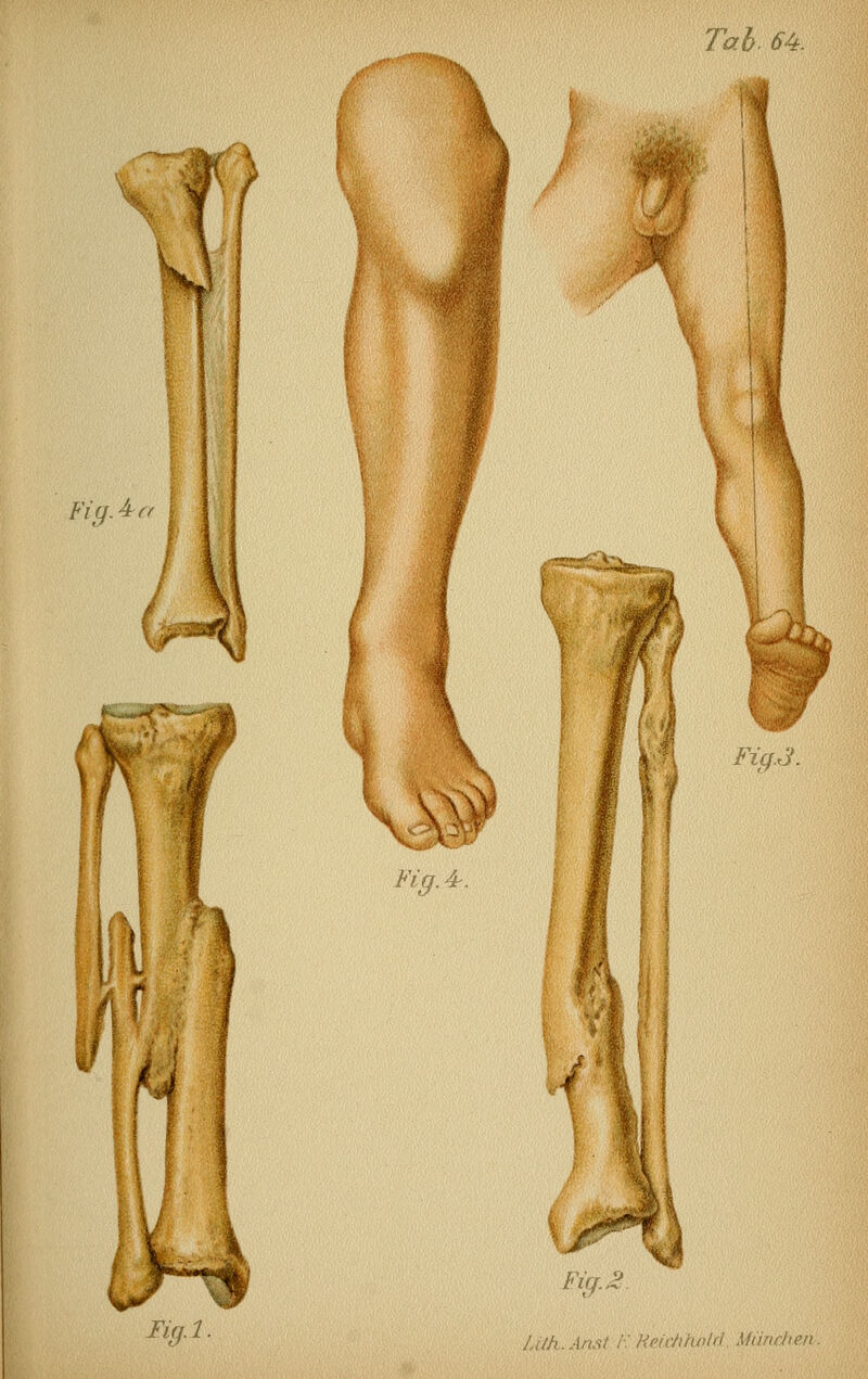 Tah. 64. Fig A Iig.l.