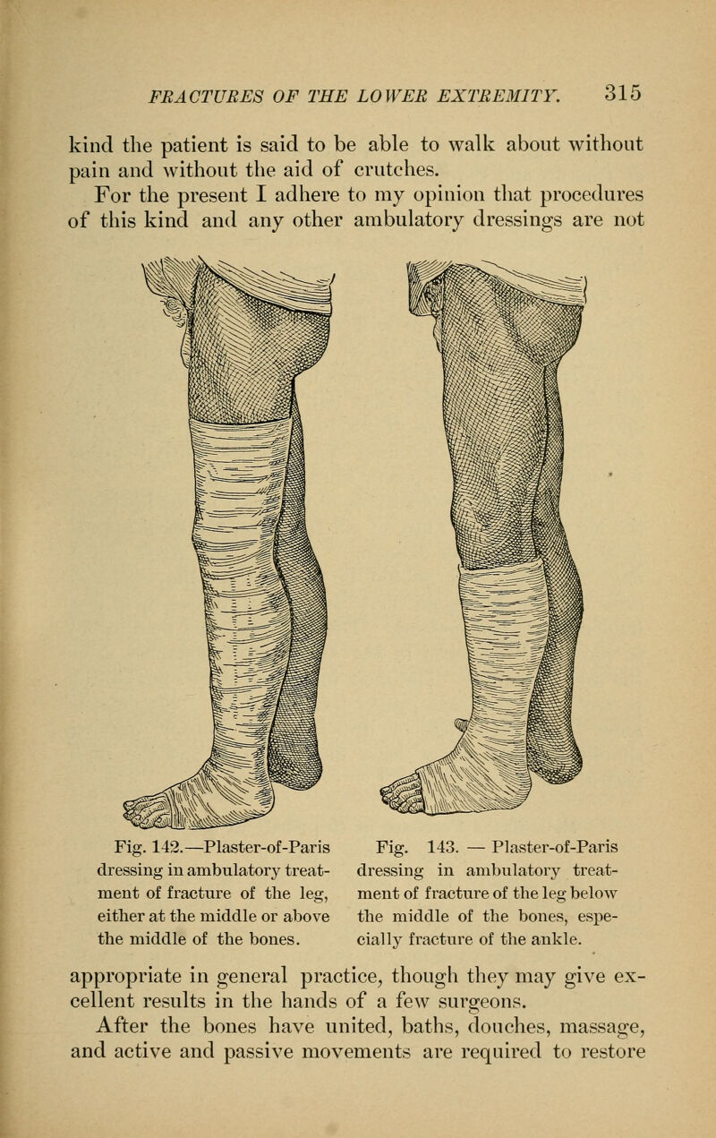 kind the patient is said to be able to walk about without pain and without the aid of crutches. For the present I adhere to my opinion that procedures of this kind and any other ambulatory dressings are not Fig. 142.—Plaster-of-Paris dressing in ambulatory treat- ment of fracture of the leg, either at the middle or above the middle of the bones. Fig. 143. — Plaster-of-Paris dressing in ambulatory treat- ment of fracture of the leg below the middle of the bones, espe- cially fracture of the ankle. appropriate in general practice, though they may give ex- cellent results in the hands of a few surgeons. After the bones have united, baths, douches, massage, and active and passive movements are required to restore