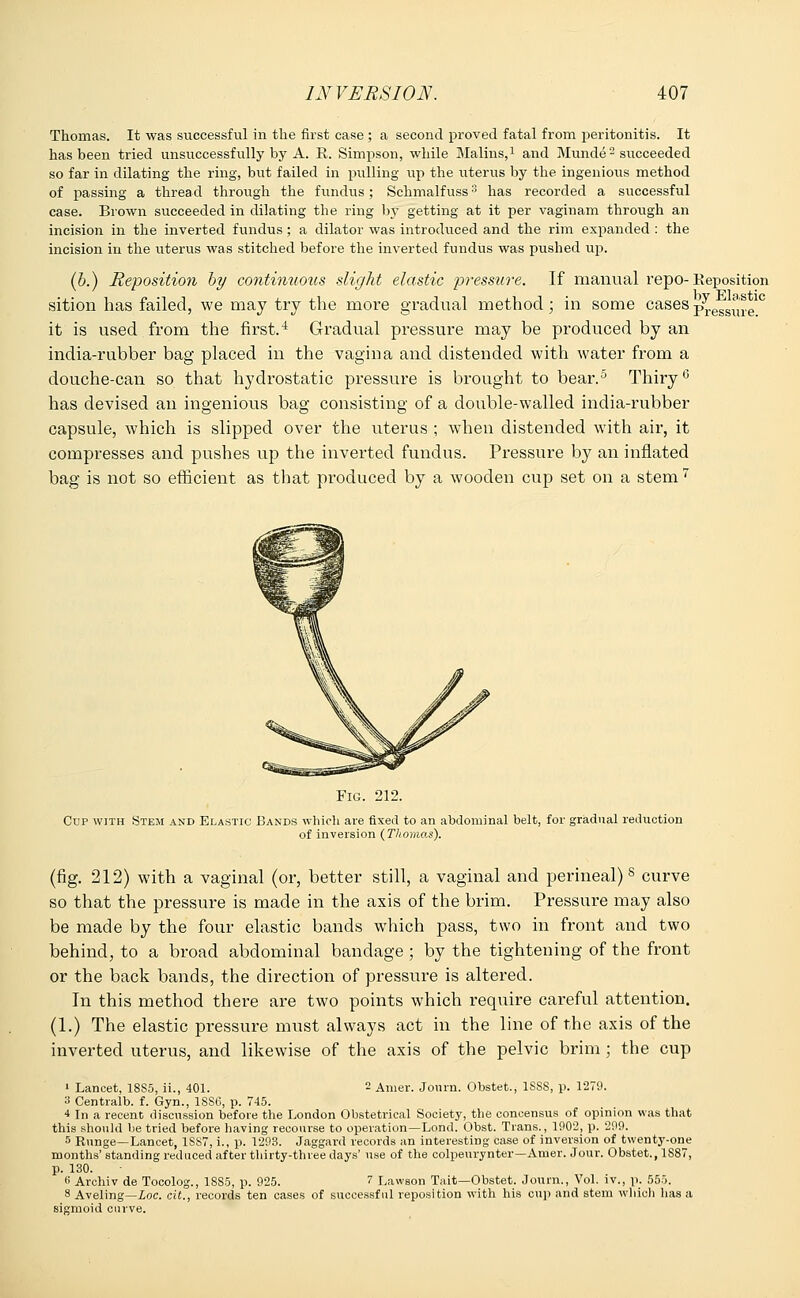 Thomas. It was successful in the first case ; a second proved fatal from peritonitis. It has been tried unsuccessfully by A. R. Simpson, while Malins,1 and Munde  succeeded so far in dilating the ring, but failed in pulling up the uterus by the ingenious method of passing a thread through the fundus; Schmalfuss3 has recorded a successful case. Brown succeeded in dilating the ring b}* getting at it per vaginam through an incision in the inverted fundus ; a dilator was introduced and the rim expanded : the incision in the uterus was stitched before the inverted fundus was pushed up. (b.) Reposition by continuous slight elastic pressure. If manual repo- Reposition sition has failed, we may try the more gradual method; in some cases p^essurelc it is used from the first.4 Gradual pressure may be produced by an india-rubber bag placed in the vagina and distended with water from a douche-can so that hydrostatic pressure is brought to bear.5 Thiry6 has devised an ingenious bag consisting of a double-walled india-rubber capsule, which is slipped over the uterus ; when distended with air, it compresses and pushes up the inverted fundus. Pressure by an inflated bag is not so efficient as that produced by a wooden cup set on a stem 7 Fig. 212. Cup with Stem and Elastic Bands which are fixed to an abdominal belt, for gradual reduction of inversion (Thomas). (fig. 212) with a vaginal (or, better still, a vaginal and perineal)8 curve so that the pressure is made in the axis of the brim. Pressure may also be made by the four elastic bands which pass, two in front and two behind, to a broad abdominal bandage ; by the tightening of the front or the back bands, the direction of pressure is altered. In this method there are two points which require careful attention. (1.) The elastic pressure must always act in the line of the axis of the inverted uterus, and likewise of the axis of the pelvic brim ; the cup 1 Lancet, 1885, ii., 401. - Anier. Joiun. Obstet., 1SS8, p. 1279. 3 Centralb. f. Gyn., 18S6, p. 745. 4 In a recent discussion before the London Obstetrical Society, the concensus of opinion was that this should be tried before having recourse to operation—Lond. Obst. Trans., 1902, p. 299. 5 Runge—Lancet, 1SS7, i., p. 1293. Jaggard records an interesting case of inversion of twenty-one months' standing reduced after thirty-three days' use of the colpeurynter—Anier. Jour. Obstet., 1S87, p. 130. 8 Archiv de Tocolog., 1SS5, p. 925. 7 Lawson Tait—Obstet. Journ., Vol. iv., p. 555. 8 Aveling—Loc. cit., records ten cases of successful reposition with his cup and stem which lias a sigmoid curve.