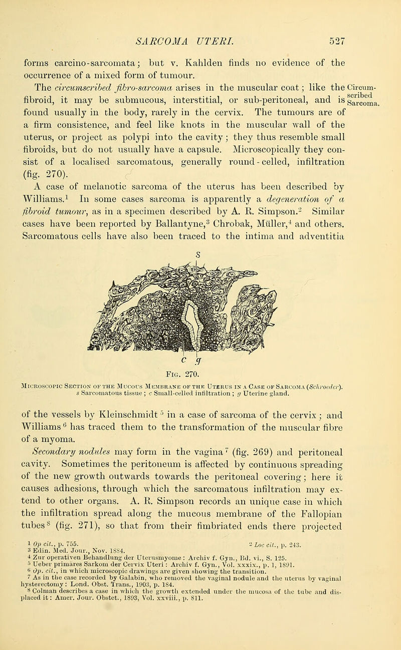 forms carcino-sarcomata; but v. Kahlden finds no evidence of the occurrence of a mixed form of tumour. The circumscribed fibrosarcoma arises in the muscular coat; like the Circum- fibroid, it may be submucous, interstitial, or sub-peritoneal, and is sarcomap found usually in the body, rarely in the cervix. The tumours are of a firm consistence, and feel like knots in the muscular wall of the uterus, or project as polypi into the cavity; they thus resemble small fibroids, but do not usually have a capsule. Microscopically they con- sist of a localised sarcomatous, generally round - celled, infiltration (fig. 270). A case of melanotic sarcoma of the uterus has been described by Williams.1 In some cases sarcoma is apparently a degeneration of a fibroid tumour, as in a specimen described by A. E,. Simpson.'-2 Similar cases have been reported by Ballantyne,3 Chrobak, Midler,4 and others. Sarcomatous cells have also been traced to the intima and adventitia Microscopic Section or the Mucous Membrane of the Uterus in a Case of Sarcoma (Schroeder). s Sarcomatous tissue ; c Small-celled infiltration ; g Uterine gland. of the vessels by Kleinschmidt 5 in a case of sarcoma of the cervix ; and Williams 6 has traced them to the transformation of the muscular fibre of a myoma. Secondary nodules may form in the vagina (fig. 269) and peritoneal cavity. Sometimes the peritoneum is affected by continuous spreading of the new growth outwards towards the peritoneal covering; here it causes adhesions, through which the sarcomatous infiltration may ex- tend to other organs. A. R. Simpson records an unique case in which the infiltration spread along the mucous membrane of the Fallopian tubess (fig. 271), so that from their fimbriated ends there projected 1 Op cit., p. 755. 2 l0c cu., p. 243. 3 Edin. Med. Jour., Nov. 1SS4. ■i Zur operativen Behandlung der Uterusmyome : Archiv f. Gyn., Bd. vi., S. 125. 5 Ueber primares Sarkom der Cervix Uteri: Archiv f. Gyn., Vol. xxxix., p. 1, 1891. 6 Op. cit., in which microscopic drawings are given showing the transition. 1 As in the case recorded by Galabin, who removed the vaginal nodule and the uterus by vagina) hysterectomy: Lond. Obst. Trans., 1903, p. 1S4. 8 Colmah describes a case in which the growth extended under the mucosa of the tube and dis- placed it: Amer. Jour. Obstet., 1S93, Vol. xxviii., p. 811.