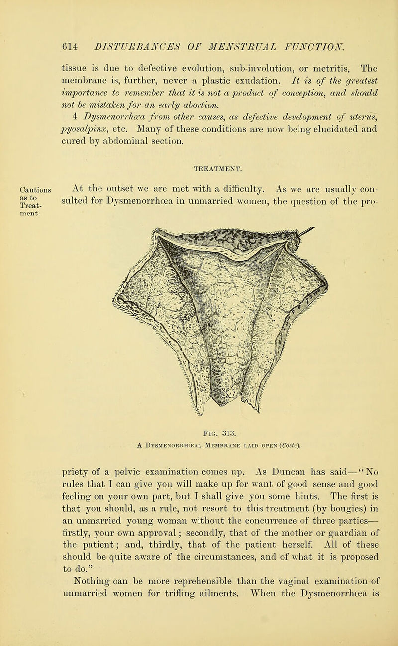 Cautions as to Treat- ment. 614 DISTURBANCES OF MENSTRUAL FUNCTION. tissue is due to defective evolution, sub-involution, or metritis. The membrane is, further, never a plastic exudation. It is of the greatest importance to remember that it is not a product of conception, and should not be mistaken for an early abortion. 4 Dysmenorrhea from other causes, as defective development of uterus, pyosalpinx, etc. Many of these conditions are now being elucidated and cured by abdominal section. TREATMENT. At the outset we are met with a difficulty. As we are usually con- sulted for Dysmenorrhea in unmarried women, the question of the pro- Fig. 313. A Dysmenorkhosal, Membrane laid open (Coste). priety of a pelvic examination comes up. As Duncan has said—No rules that I can give you will make up for want of good sense and good feeling on your own part, but I shall give you some hints. The first is that you should, as a rule, not resort to this treatment (by bougies) in an unmarried young woman without the concurrence of three parties— firstly, your own approval; secondly, that of the mother or guardian of the patient; and, thirdly, that of the patient herself. All of these should be quite aware of the circumstances, and of what it is proposed to do. Nothing can be more reprehensible than the vaginal examination of unmarried women for trifling ailments. When the Dysmenorrhoea is