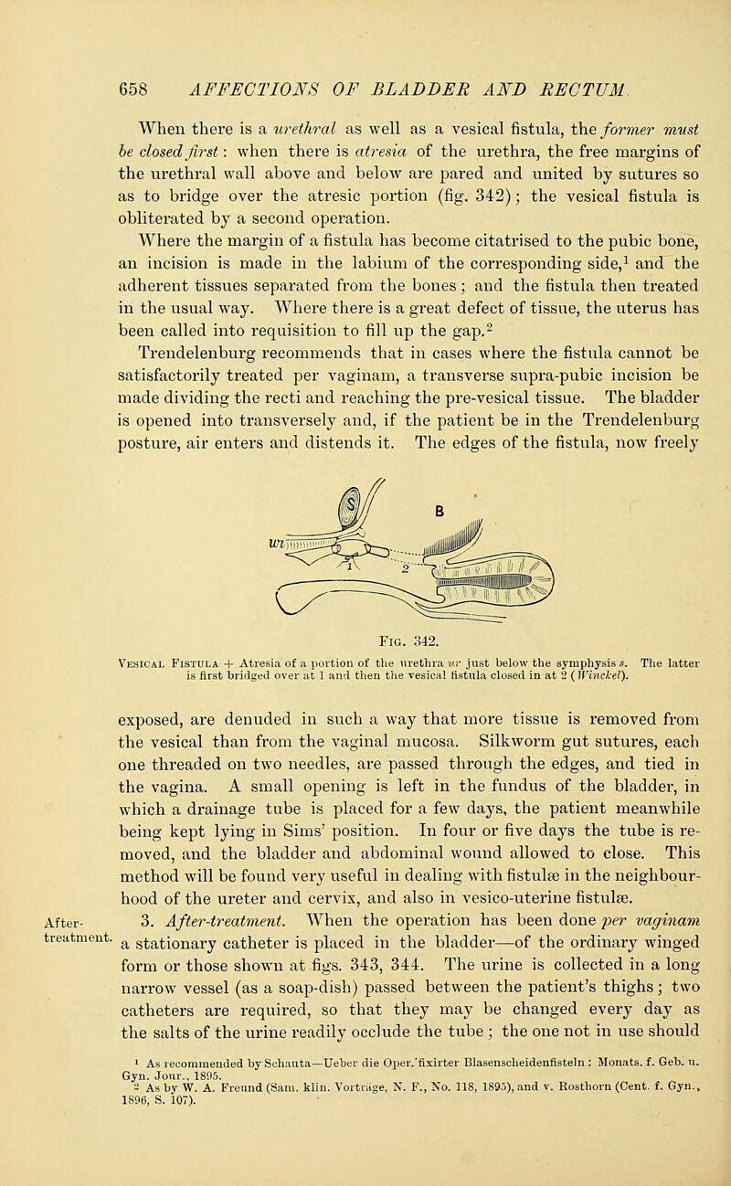 When there is a urethral as well as a vesical fistula, the former must be closed first: when there is atresia of the urethra, the free margins of the urethral wall above and below are pared and united by sutures so as to bridge over the atresic portion (fig. 342); the vesical fistula is obliterated by a second operation. Where the margin of a fistula has become citatrised to the pubic bone, an incision is made in the labium of the corresponding side,1 and the adherent tissues separated from the bones ; and the fistula then treated in the usual way. Where there is a great defect of tissue, the uterus has been called into requisition to fill up the gap.2 Trendelenburg recommends that in cases where the fistula cannot be satisfactorily treated per vaginam, a transverse supra-pubic incision be made dividing the recti and reaching the pre-vesical tissue. The bladder is opened into transversely and, if the patient be in the Trendelenburg posture, air enters and distends it. The edges of the fistula, now freely Fig. 342. Vesical Fistula + Atresia of a portion of the urethra ur just below the symphysis s. The latter is first bridged over at 1 and then the vesical fistula closed in at 2 ( Winckel). After- treatment, exposed, are denuded in such a way that more tissue is removed from the vesical than from the vaginal mucosa. Silkworm gut sutures, each one threaded on two needles, are passed through the edges, and tied in the vagina. A small opening is left in the fundus of the bladder, in which a drainage tube is placed for a few days, the patient meanwhile being kept lying in Sims' position. In four or five days the tube is re- moved, and the bladder and abdominal wound allowed to close. This method will be found very useful in dealing with fistulse in the neighbour- hood of the ureter and cervix, and also in vesico-uterine fistulas. 3. After-treatment. When the operation has been done per vaginam a stationary catheter is placed in the bladder—of the ordinary winged form or those shown at figs. 343, 344. The urine is collected in a long narrow vessel (as a soap-dish) passed between the patient's thighs; two catheters are required, so that they may be changed every day as the salts of the urine readily occlude the tube ; the one not in use should 1 As recommended by Schauta—Ueber die Oper.'fixirter Blasenscheidenfisteln : Monats. f. Geb. u. Gyn. Jour., 1895. 2 As by W. A. Freund (Sam. klin. Vortriige, N. F., No. 118, 1895), and v. Rosthorn (Cent. f. Gyn., 1896, S. 107).