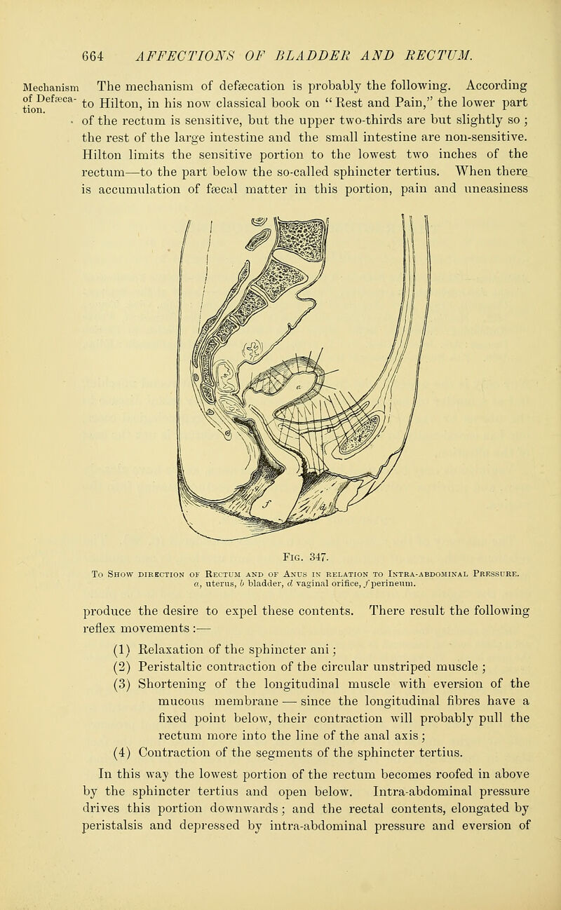 Mechanism of Defaeca- tion. The mechanism of defsecation is probably the following. According to Hilton, in his now classical book on  Rest and Pain, the lower part of the rectum is sensitive, but the upper two-thirds are but slightly so ; the rest of the large intestine and the small intestine are non-sensitive. Hilton limits the sensitive portion to the lowest two inches of the rectum—to the part below the so-called sphincter tertius. When there is accumulation of fsecal matter in this portion, pain and uneasiness Fig. 347. To Show direction of Rectum and of Anus in relation to Intra-abdominal Pressure. a, uterus, 6 bladder, d vaginal orifice, /perineum. produce the desire to expel these contents. There result the following reflex movements:— (1) Relaxation of the sphincter ani; (2) Peristaltic contraction of the circular unstriped muscle ; (3) Shortening of the longitudinal muscle with eversion of the mucous membrane — since the longitudinal fibres have a fixed point below, their contraction will probably pull the rectum more into the line of the anal axis; (4) Contraction of the segments of the sphincter tertius. In this way the lowest portion of the rectum becomes roofed in above by the sphincter tertius and open below. Intra-abdominal pressure drives this portion downwards; and the rectal contents, elongated by peristalsis and depressed by intra-abdominal pressure and eversion of