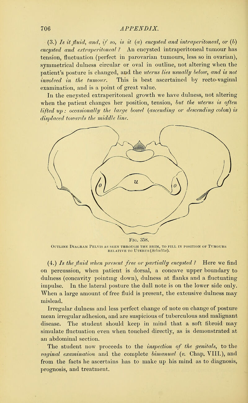 (3.) Is it fluid, and, if so, is it (a) encysted and intraperitoneal, or (b) encysted and extraperitoneal ? An encysted intraperitoneal tumour has tension, fluctuation (perfect in parovarian tumours, less so in ovarian), symmetrical dulness circular or oval in outline, not altering when the patient's posture is changed, and the uterus lies usually beloiv, and is not involved in the tumour. This is best ascertained by recto-vaginal examination, and is a point of great value. In the encysted extraperitoneal growth we have dulness, not altering when the patient changes her position, tension, but the uterus is often lifted up: occasionally the large bowel (ascending or descending colon) is displaced towards the middle line. Fig. 358. Outline Diagram Pelvis as seen through the brim, to fill in position of Txtmours RELATIVE TO UTERUS {Scjiultze). (4.) Is the fluid when present free or partially encysted ? Here we find on percussion, when patient is dorsal, a concave upper boundary to dulness (concavity pointing down), dulness at flanks and a fluctuating impulse. In the lateral posture the dull note is on the lower side only. When a large amount of free fluid is present, the extensive dulness may mislead. Irregular dulness and less perfect change of note on change of posture mean irregular adhesion, and are suspicious of tuberculous and malignant disease. The student should keep in mind that a soft fibroid may simulate fluctuation even when touched directly, as is demonstrated at an abdominal section. The student now proceeds to the inspection of the genitals, to the vaginal examination and the complete bimanual (v. Chap. VIII.), and from the facts he ascertains has to make up his mind as to diagnosis, prognosis, and treatment.