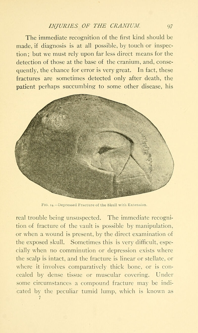 The immediate recognition of the first kind should be made, if diagnosis is at all possible, by touch or inspec- tion ; but we must rely upon far less direct means for the detection of those at the base of the cranium, and, conse- quently, the chance for error is very great. In fact, these fractures are sometimes detected only after death, the patient perhaps succumbing to some other disease, his Fig. 14.—Depressed Fracture of the Skull with Extension. real trouble being unsuspected. The immediate recogni- tion of fracture of the vault is possible by manipulation, or when a wound is present, by the direct examination of the exposed skull. Sometimes this is very difficult, espe- cially when no comminution or depression exists where the scalp is intact, and the fracture is linear or stellate, or where it involves comparatively thick bone, or is con- cealed by dense tissue or muscular covering. Under some circumstances a compound fracture may be indi- cated by the peculiar tumid lump, which is known as