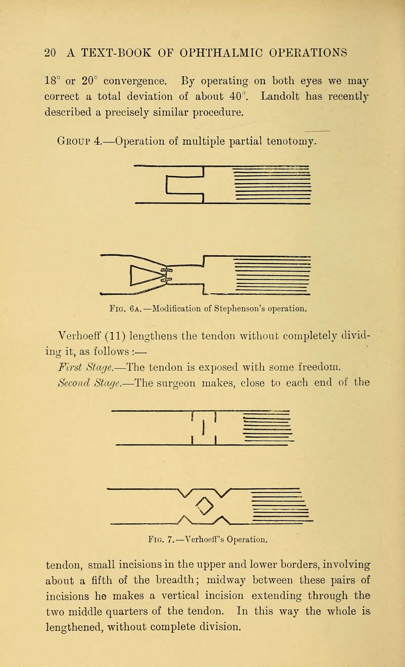 18° or 20° convergence. By operating on both eyes we may correct a total deviation of about 40°. Landolt has recently described a precisely similar procedure. Group 4.—Operation of multiple partial tenotomy. Fig. 6a. —Modification of Stephenson's operation. Verhoeff (11) lengthens the tendon without completely divid- ing it, as follows :— First Stage.—The tendon is exposed with some freedom. Second Stage.—The surgeon makes, close to each end of the Fig. 7.—Verhoeff's Operation. tendon, small incisions in the upper and lower borders, involving about a fifth of the breadth; midway between these pairs of incisions he makes a vertical incision extending through the two middle quarters of the tendon. In this way the whole is lengthened, without complete division.