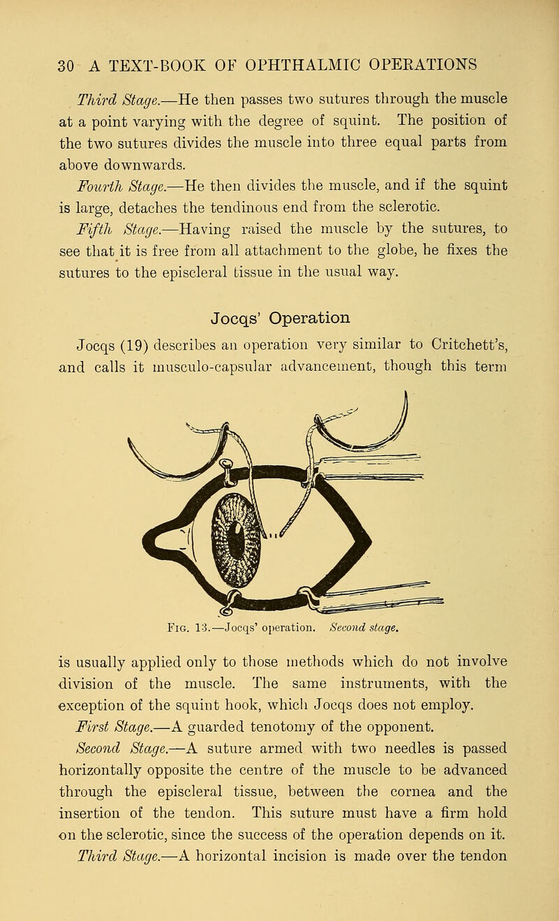 Third Stage.—He then passes two sutures through the muscle at a point varying with the degree of squint. The position of the two sutures divides the muscle into three equal parts from above downwards. Fourth Stage.—He then divides the muscle, and if the squint is large, detaches the tendinous end from the sclerotic. Fifth Stage.—Having raised the muscle by the sutures, to see that it is free from all attachment to the globe, he fixes the sutures to the episcleral tissue in the usual way. Jocqs' Operation Jocqs (19) describes an operation very similar to Critchett's, and calls it musculo-capsular advancement, though this term Fig. 13.—Jocqs' operation. Second stage. is usually applied only to those methods which do not involve division of the muscle. The same instruments, with the exception of the squint hook, which Jocqs does not employ. First Stage.—A guarded tenotomy of the opponent. Second Stage.—A suture armed with two needles is passed horizontally opposite the centre of the muscle to be advanced through the episcleral tissue, between the cornea and the insertion of the tendon. This suture must have a firm hold on the sclerotic, since the success of the operation depends on it. Third Stage.—A horizontal incision is made over the tendon