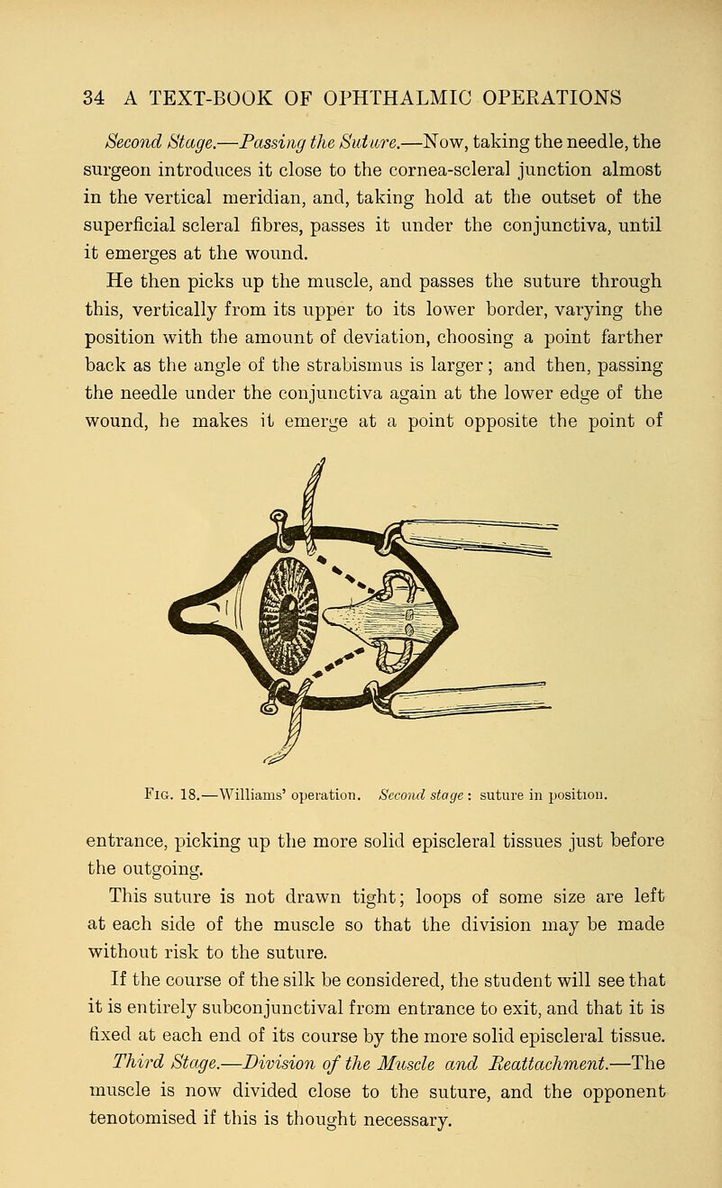 Second Stage.—Passing the Suture.—Now, taking the needle, the surgeon introduces it close to the cornea-scleral junction almost in the vertical meridian, and, taking hold at the outset of the superficial scleral fibres, passes it under the conjunctiva, until it emerges at the wound. He then picks up the muscle, and passes the suture through this, vertically from its upper to its lower border, varying the position with the amount of deviation, choosing a point farther back as the angle of the strabismus is larger; and then, passing the needle under the conjunctiva again at the lower edge of the wound, he makes it emerge at a point opposite the point of Fig. 18.—Williams' operation. Second stage : suture in position. entrance, picking up the more solid episcleral tissues just before the outgoing. This suture is not drawn tight; loops of some size are left at each side of the muscle so that the division may be made without risk to the suture. If the course of the silk be considered, the student will see that it is entirely subconjunctival from entrance to exit, and that it is fixed at each end of its course by the more solid episcleral tissue. Third Stage.—Division of the Muscle and Reattachment.—The muscle is now divided close to the suture, and the opponent tenotomised if this is thought necessary.