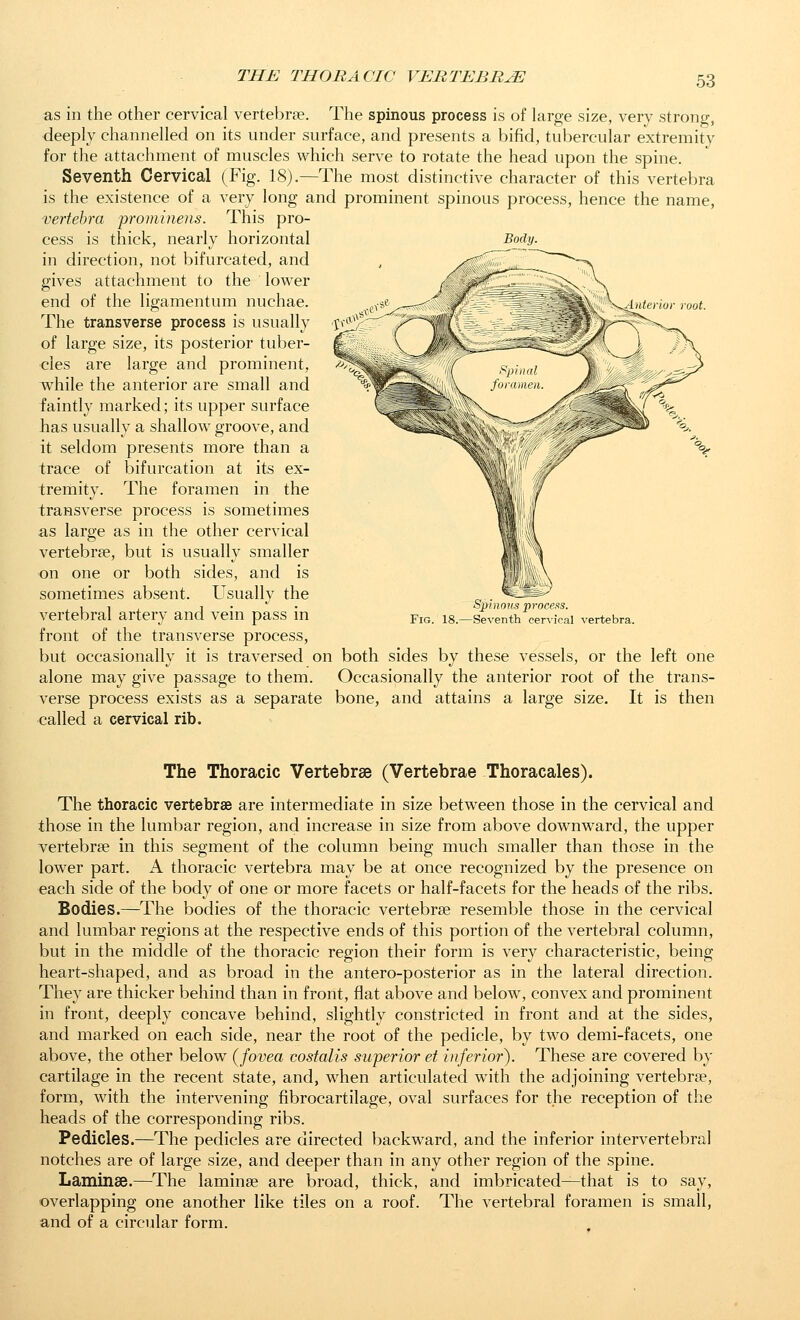 Body. as in the other cervical vertebrae. The spinous process is of large size, very strong, deeply channelled on its under surface, and presents a bifid, tubercular extremity for the attachment of muscles which serve to rotate the head upon the spine. Seventh Cervical (Fig. 18).—The most distinctive character of this vertebra is the existence of a very long and prominent spinous process, hence the name, vertebra 'prominens. This pro- cess is thick, nearly horizontal in direction, not bifurcated, and gives attachment to the lower end of the ligamentum nuchae. The transverse process is usually of large size, its posterior tuber- cles are large and prominent, while the anterior are small and faintly marked; its upper surface has usually a shallow groove, and it seldom presents more than a trace of bifurcation at its ex- tremity. The foramen in the transverse process is sometimes as large as in the other cervical vertebrae, but is usually smaller on one or both sides, and is sometimes absent. Usually the vertebral artery and vein pass in front of the transverse process, but occasionally it is traversed on both sides by these vessels, or the left one alone may give passage to them. Occasionally the anterior root of the trans- verse process exists as a separate bone, and attains a large size. It is then called a cervical rib. Fig. 18. Spinous process. -Seventh cervical vertebra. The Thoracic Vertebrae (Vertebrae Thoracales). The thoracic vertebrae are intermediate in size between those in the cervical and those in the lumbar region, and increase in size from above downward, the upper vertebrae in this segment of the column being much smaller than those in the lower part. A thoracic vertebra may be at once recognized by the presence on each side of the body of one or more facets or half-facets for the heads of the ribs. Bodies.—The bodies of the thoracic vertebrae resemble those in the cervical and lumbar regions at the respective ends of this portion of the vertebral column, but in the middle of the thoracic region their form is very characteristic, being heart-shaped, and as broad in the antero-posterior as in the lateral direction. They are thicker behind than in front, flat above and below, convex and prominent in front, deeply concave behind, slightly constricted in front and at the sides, and marked on each side, near the root of the pedicle, by two demi-facets, one above, the other below (fovea costalis superior et inferior^ These are covered by cartilage in the recent state, and, when articulated with the adjoining vertebrae, form, with the intervening fibrocartilage, oval surfaces for the reception of the heads of the corresponding ribs. Pedicles.—The pedicles are directed backward, and the inferior intervertebral notches are of large size, and deeper than in any other region of the spine. Laminae.—The laminae are broad, thick, and imbricated—that is to say, overlapping one another like tiles on a roof. The vertebral foramen is small, and of a circular form.