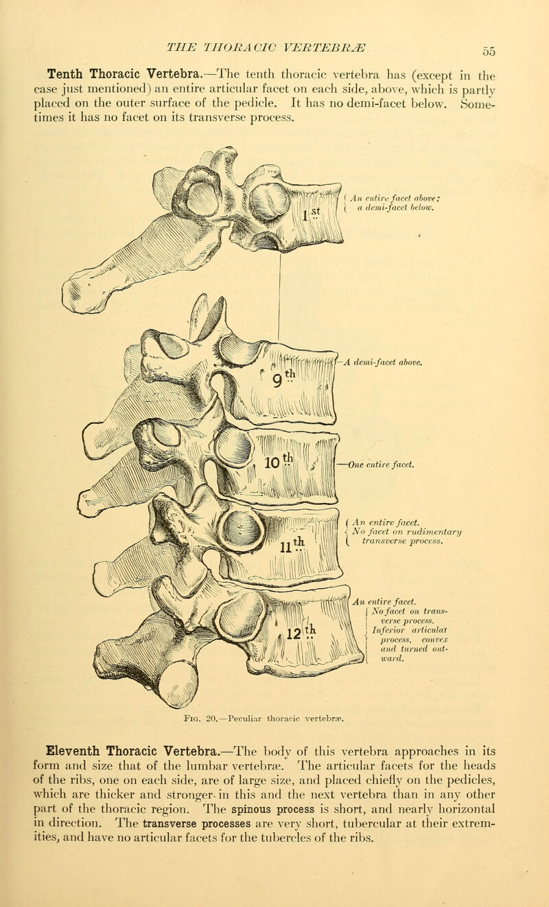 Tenth Thoracic Vertebra.—The tenth thoracic vertebra has (except in the case just mentioned) an entire articular facet on each side, above, which is partly placed on the outer surface of the pedicle. It has no demi-facet below. Some- times it has no facet on its transverse process. i ^' J I / \ An entire facet above; ''1 -f (£ -i St I \ ^ demi-facet below. ■iMfdl—A demi-facet above. One entire facet. ( An entire facet. ■I No facet on rudimentary (^ transverse -process. An entire facet. f No facet on trans- verse process. Inferior articular process, convex ^^\ '^ turned out- ward. Fig. 20.—Peculiar thoracic vertebrae. Eleventh Thoracic Vertebra.—^The body of this vertebra approaches in its form and size that of the lumbar vertebrae. The articular facets for the heads of the ribs, one on each side, are of large size, and placed chiefly on the pedicles, which are thicker and stronger- in this and the next vertebra than in any other part of the thoracic region. The spinous process is short, and nearly horizontal in direction. The transverse processes are very short, tubercular at their extrem- ities, and have no articular facets for the tubercles of the ribs.
