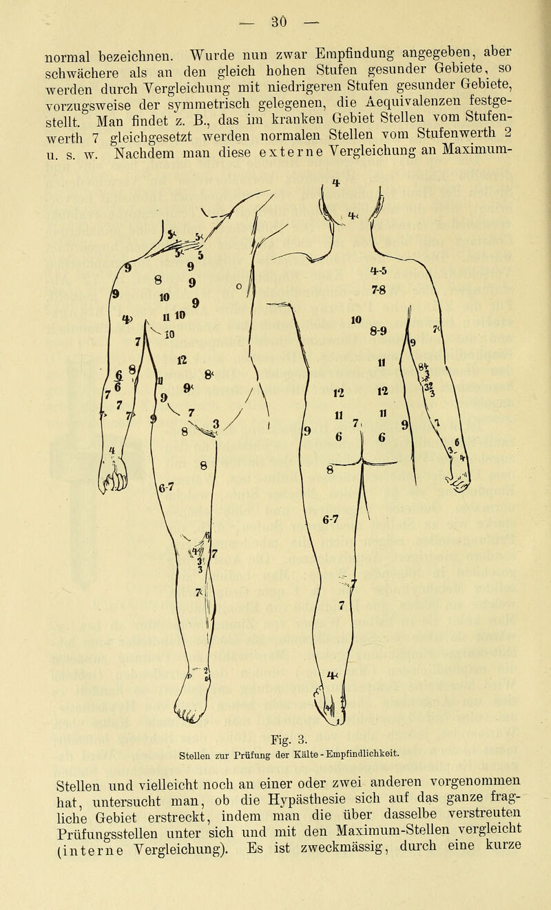 normal bezeichnen. Wurde nun zwar Empfindung angegeben, aber schwächere als an den gleich hohen Stufen gesunder Gebiete, so werden durch Vergleichung mit niedrigeren Stufen gesunder Gebiete, vorzugsweise der symmetrisch gelegenen, die Aequivalenzen festge- stellt. Man findet z. B., das im kranken Gebiet Stellen vom Stufen- werth 7 gleichgesetzt werden normalen Stellen vom Stufenwerth 2 u. s. w. Nachdem man diese externe Yergleichung an Maximum- Fig. 3. Stellen zur Prüfung der Kälte - Empfindlichkeit. Stellen nnd vielleicht noch an einer oder zwei anderen vorgenommen hat, untersucht man, ob die Hypästhesie sich auf das ganze frag- hche Gebiet erstreckt, indem man die über dasselbe verstreuten Prüfungsstellen unter sich und mit den Maximum-Stellen vergleicht (interne Yergleichung). Es ist zweckmässig, durch eine kurze