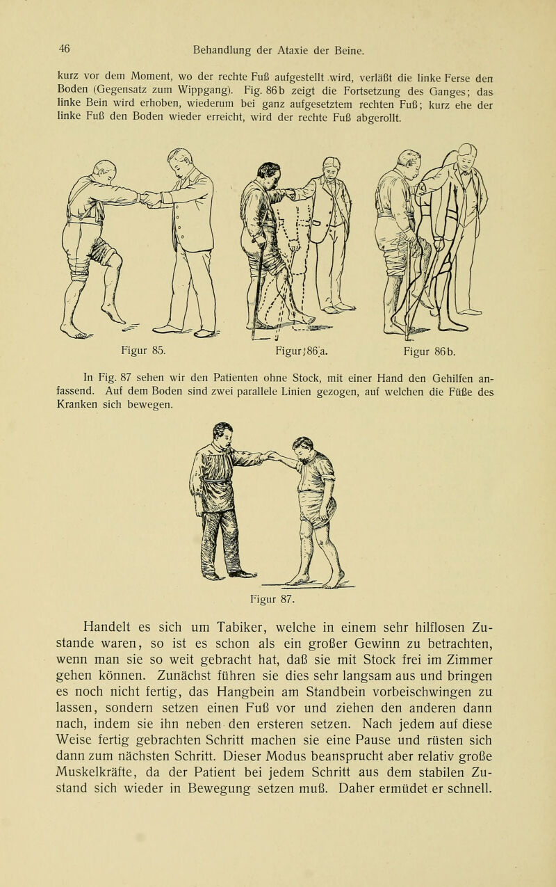 kurz vor dem Moment, wo der rechte Fuß aufgestellt wird, verläßt die linke Ferse den Boden (Gegensatz zum Wippgang). Fig. 86b zeigt die Fortsetzung des Ganges; das linke Bein wird erhoben, wiederum bei ganz aufgesetztem rechten Fuß; kurz ehe der linke Fuß den Boden wieder erreicht, wird der rechte Fuß abgerollt. Figur 85 Figur jJ Figur 86b. In Fig. 87 sehen wir den Patienten ohne Stock, mit einer Hand den Gehilfen an- fassend. Auf dem Boden sind zwei parallele Linien gezogen, auf welchen die Füße des Kranken sich bewegen. Figur 87. Handelt es sich um Tabiker, welche in einem sehr hilflosen Zu- stande waren, so ist es schon als ein großer Gewinn zu betrachten, wenn man sie so weit gebracht hat, daß sie mit Stock frei im Zimmer gehen können. Zunächst führen sie dies sehr langsam aus und bringen es noch nicht fertig, das Hangbein am Standbein vorbeischwingen zu lassen, sondern setzen einen Fuß vor und ziehen den anderen dann nach, indem sie ihn neben den ersteren setzen. Nach jedem auf diese Weise fertig gebrachten Schritt machen sie eine Pause und rüsten sich dann zum nächsten Schritt. Dieser Modus beansprucht aber relativ große Muskelkräfte, da der Patient bei jedem Schritt aus dem stabilen Zu- stand sich wieder in Bewegung setzen muß. Daher ermüdet er schnell.