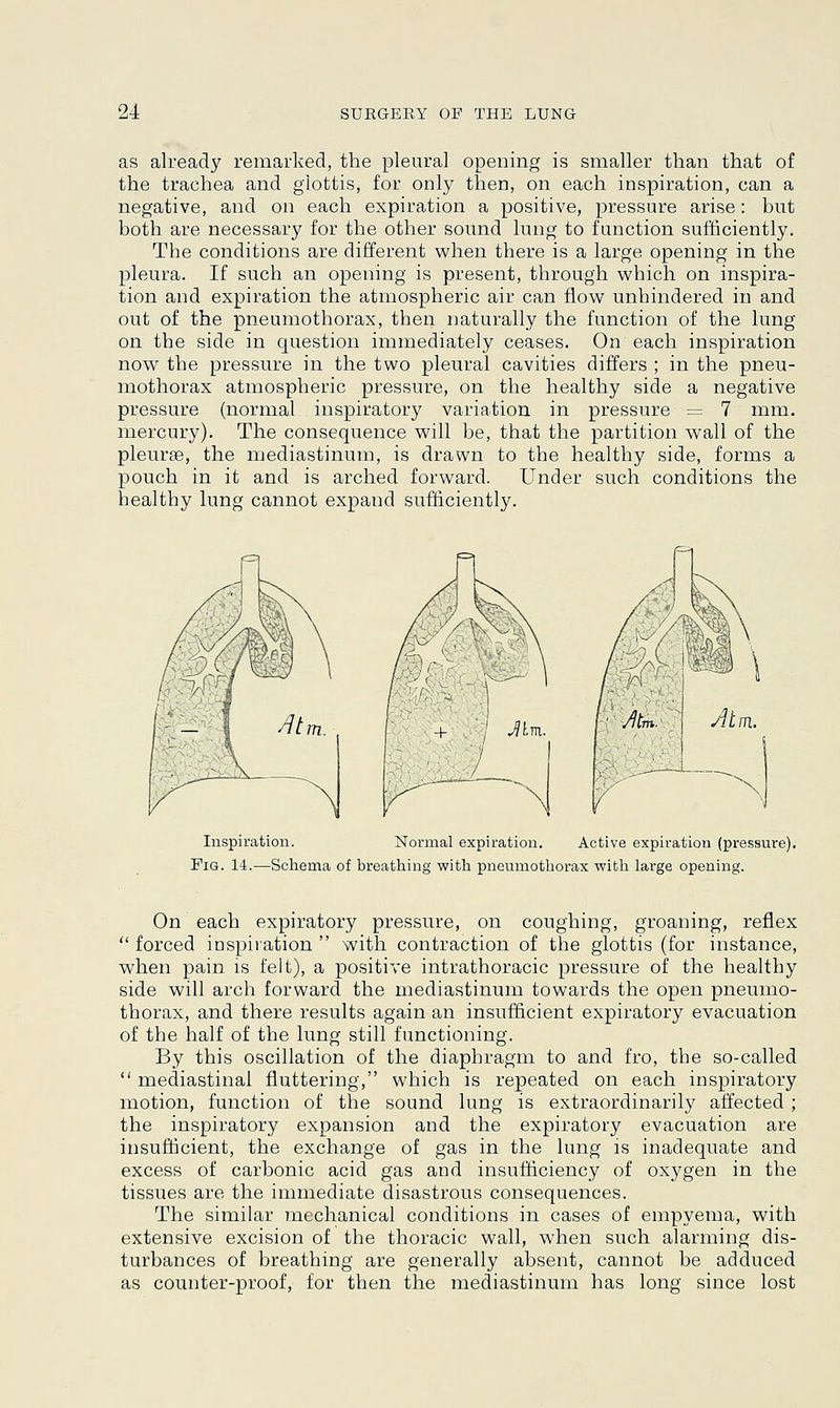 as already remarked, the pleural opening is smaller than that of the trachea and glottis, for only then, on each inspiration, can a negative, and on each expiration a positive, pressure arise: but both are necessary for the other sound lung to function sufficiently. The conditions are different when there is a large opening in the pleura. If such an opening is present, through which on inspira- tion and expiration the atmospheric air can flow unhindered in and out of the pneumothorax, then naturally the function of the lung on the side in question immediately ceases. On each inspiration now the pressure in the two pleural cavities differs ; in the pneu- mothorax atmospheric pressure, on the healthy side a negative pressure (normal inspiratory variation in pressure = 7 mm. mercury). The consequence will be, that the partition wall of the pleurse, the mediastinum, is drawn to the healthy side, forms a pouch in it and is arched forward. Under such conditions the healthy lung cannot expand sufficiently. Inspiration. Normal expiration. Active expiration (pressure). Pig. 14.—Schema of breathing with pneumothorax with large opening. On each expiratory pressure, on coughing, groaning, reflex  forced inspiration  with contraction of the glottis (for instance, when pain is felt), a positive intrathoracic pressure of the healthy side will arch forward the mediastinum towards the open pneumo- thorax, and there results again an insufficient expiratory evacuation of the half of the lung still functioning. By this oscillation of the diaphragm to and fro, the so-called  mediastinal fluttering, which is repeated on each inspiratory motion, function of the sound lung is extraordinarily affected; the inspiratory expansion and the expiratory evacuation are insufficient, the exchange of gas in the lung is inadequate and excess of carbonic acid gas and insufficiency of oxygen in the tissues are the immediate disastrous consequences. The similar mechanical conditions in cases of empyema, with extensive excision of the thoracic wall, when such alarming dis- turbances of breathing are generally absent, cannot be adduced as counter-proof, for then the mediastinum has long since lost