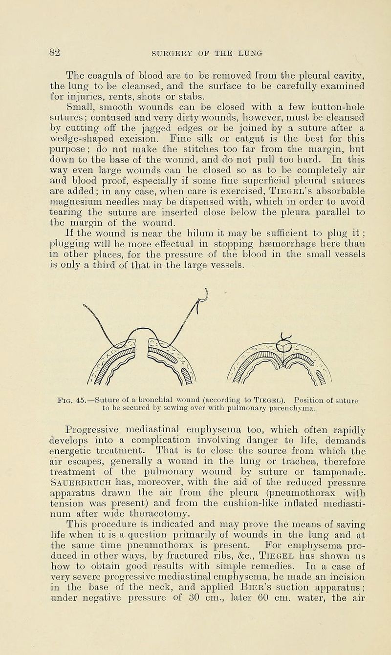 The coagula of blood are to be removed from the pleural cavity, the lung to be cleansed, and the surface to be carefully examined for injuries, rents, shots or stabs. Small, smooth wounds can be closed with a few button-hole sutures; contused and very dirty wounds, however, must be cleansed by cutting off the jagged edges or be joined by a suture after a wedge-shaped excision. Fine silk or catgut is the best for this purpose; do not make the stitches too far from the margin, but down to the base of the wound, and do not pull too hard. In this way even large wounds can be closed so as to be completely air and blood proof, especially if some fine superficial pleural sutures are added; in any case, when care is exercised, Tiegel's absorbable magnesium needles may be dispensed with, which in order to avoid tearing the suture are inserted close below the pleura parallel to the margin of the wound. If the wound is near the hilum it may be sufficient to plug it ; plugging will be more effectual in stopping haemorrhage here than in other places, for the pressure of the blood in the small vessels is only a third of that in the large vessels. Fig. 45.—Suture of a bronchial wound (according to Tiegbl). Position of suture to be secured by sewing over with pulmonary parenchyma. Progressive mediastinal emphysema too, which often rapidly develops into a complication involving danger to life, demands energetic treatment. That is to close the source from which the air escapes, generally a wound in the lung or trachea, therefore treatment of the pulmonary wound by suture or tamponade. Sauerbruch has, moreover, with the aid of the reduced pressure apparatus drawn the air from the pleura (pneumothorax with tension was present) and from the cushion-like inflated mediasti- num after wide thoracotomy. This procedure is indicated and may prove the means of saving life when it is a question primarily of wounds in the lung and at the same time pneumothorax is present. For emphysema pro- duced in other ways, by fractured ribs, &c, Tiegel has shown us how to obtain good results with simple remedies. In a case of very severe progressive mediastinal emphysema, he made an incision in the base of the neck, and applied Bier's suction apparatus; under negative pressure of 30 cm., later 60 cm. water, the air