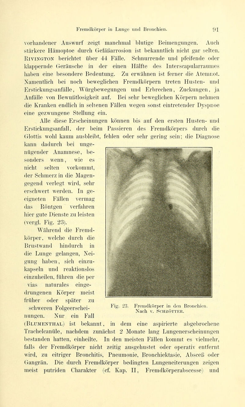 vorhandener Auswurf zeigt manchmal blutige Beimengungen. Auch stärkere Hämoptoe durch Gefäßarrosion ist bekanntlich nicht gar selten. Rivington berichtet über 44 Fälle. Schnurrende und pfeifende oder klappernde Geräusche in der einen Hälfte des Interscapularraumes haben eine besondere Bedeutung. Zu erwähnen ist ferner die Atemnot. Namentlich bei noch beweglichen Fremdkörpern treten Husten- und Erstickungsanfälle, Würgbewegungen und Erbrechen, Zuckungen, ja Anfälle von Bewußtlosigkeit auf. Bei sehr beweglichen Körpern nehmen die Kranken endlich in seltenen Fällen wegen sonst eintretender Dyspnoe eine gezwungene Stellung ein. Alle diese Erscheinungen können bis auf den ersten Husten- und Erstickungsanfall, der beim Passieren des Fremdkörpers durch die Glottis wohl kaum ausbleibt, fehlen oder sehr gering sein; die Diagnose kann dadurch bei unge- nügender Anamnese, be- sonders wenn, wie es nicht selten vorkommt, der Schmerz in die Magen- gegend verlegt wird, sehr erschwert werden. In ge- eigneten Fällen vermag das Röntgen verfahren hier gute Dienste zu leisten (vergl. Fig. 23). Während die Fremd- körper, welche durch die Brustwand hindurch in die Lunge gelangen, Nei- gung haben, sich einzu- kapseln und reaktionslos einzuheilen, führen die per vias naturales einge- drungenen Körper meist früher oder später zu schweren Folgeerschei- nungen. Nur ein Fall (Blumenthal) ist bekannt, in dem eine aspirierte abgebrochene Trachelcanüle, nachdem zunächst 2 Monate lang Lungenerscheinungen bestanden hatten, einheilte. In den meisten Fällen kommt es vielmehr, falls der Fremdkörper nicht zeitig ausgehustet oder operativ entfernt wird, zu eitriger Bronchitis, Pneumonie, Bronchiektasie, Absceß oder Gangrän. Die durch Fremdkörper bedingten Lungeneiterungen zeigen meist putriden Charakter (cf. Kap. II, Fremdkörperabscesse) und Fig. 23. Fremdkörper in den Bronchien. Nach v. Schrötter.