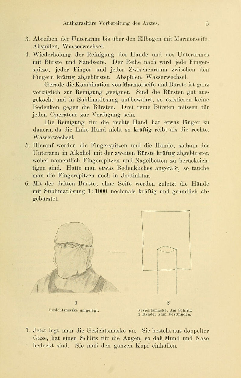 Abreiben der Unterarme bis über den Ellbogen mit Marmorseife. Abspülen, Wasserwechsel. Wiederholung der Reinigung der Hände und des Unterarmes mit Bürste und Sandseife. Der Reihe nach wird jede Finger- spitze, jeder Finger und jeder Zwischenraum zwischen den Fingern kräftig abgebürstet. Abspülen, Wasserwechsel. Gerade die Kombination von Marmorseife und Bürste ist ganz vorzüglich zur Reinigung geeignet. Sind die Bürsten gut aus- gekocht und in Sublimatlösung aufbewahrt, so existieren keine Bedenken gegen die Bürsten. Drei reine Bürsten müssen für jeden Operateur zur Verfügung sein. Die Reinigung für die rechte Hand hat etwas länger zu dauern, da die linke Hand nicht so kräftig reibt als die rechte. Wasserwechsel. Hierauf werden die Fingerspitzen und die Hände, sodann der Unterarm in Alkohol mit der zweiten Bürste kräftig abgebürstet, wobei namentlich Fingerspitzen und Nagelbetten zu berücksich- tigen sind. Hatte man etwas Bedenkliches angefaßt, so tauche man die Fingerspitzen noch in Jodtinktur. Mit der dritten Bürste, ohne Seife werden zuletzt die Hände mit Sublimatlösung 1: 1000 nochmals kräftig und gründlich ab- gebürstet. ., ' Gesichtsmaske umgelegt. Gesichtsmaske. Am Schlitz 2 Bänder zum Festbinden. 7. Jetzt legt man die Gesichtsmaske an. Sie besteht aus doppelter Gaze, hat einen Schlitz für die Augen, so daß Mund und Nase bedeckt sind. Sie muß den ganzen Kopf einhüllen.