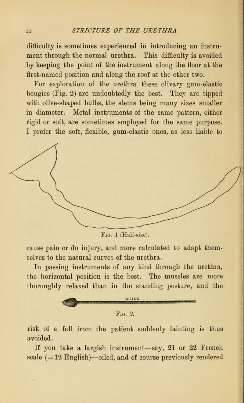 difficulty is sometimes experienced in introducing an instru- ment through the normal urethra. This difficulty is avoided by keeping the point of the instrument along the floor at the first-named position and along the roof at the other two. For exploration of the urethra these olivary gum-elastic bougies (Fig. 2) are undoubtedly the best. They are tipped with olive-shaped bulbs, the stems being many sizes smaller in diameter. Metal instruments of the same pattern, either rigid or soft, are sometimes employed for the same purpose. I prefer the soft, flexible, gum-elastic ones, as less liable to Fig. 1 (Half-size). cause pain or do injury, and more calculated to adapt them- selves to the natural curves of the urethra. In passing instruments of any kind through the urethra, the horizontal position is the best. The muscles are more thoroughly relaxed than in the standing posture, and the WEISS Fig. 2. risk of a fall from the patient suddenly fainting is thus avoided. If you take a largish instrument—say, 21 or 22 French scale ( = 12 English)—oiled, and of course previously rendered