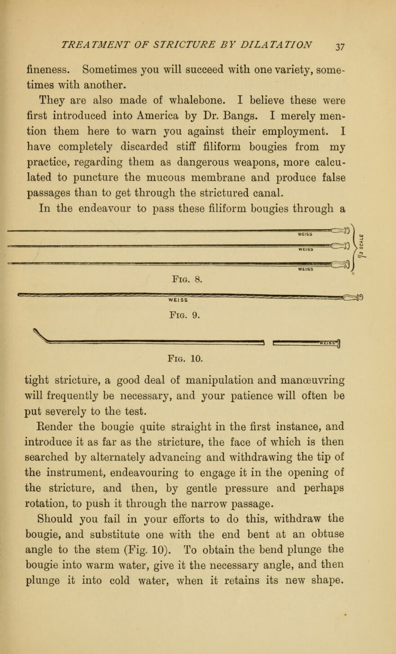 fineness. Sometimes you will succeed with one variety, some- times with another. They are also made of whalebone. I believe these were first introduced into America by Dr. Bangs. I merely men- tion them here to warn you against their employment. I have completely discarded stiff filiform bougies from my practice, regarding them as dangerous weapons, more calcu- lated to puncture the mucous membrane and produce false passages than to get through the strictured canal. In the endeavour to pass these filiform bougies through a 411^ .JJPgW^PgHg Fig. 8. Fig. 9. I P  ■l-1 WLIbbg Fig. 10. tight stricture, a good deal of manipulation and manoeuvring will frequently be necessary, and your patience will often be put severely to the test. Bender the bougie quite straight in the first instance, and introduce it as far as the stricture, the face of which is then searched by alternately advancing and withdrawing the tip of the instrument, endeavouring to engage it in the opening of the stricture, and then, by gentle pressure and perhaps rotation, to push it through the narrow passage. Should you fail in your efforts to do this, withdraw the bougie, and substitute one with the end bent at an obtuse angle to the stem (Fig. 10). To obtain the bend plunge the bougie into warm water, give it the necessary angle, and then plunge it into cold water, when it retains its new shape.