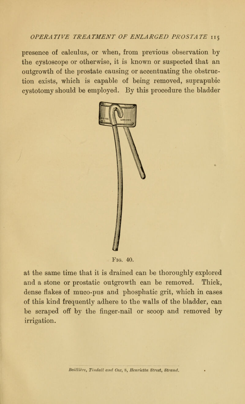 presence of calculus, or when, from previous observation by the cystoscope or otherwise, it is known or suspected that an outgrowth of the prostate causing or accentuating the obstruc- tion exists, which is capable of being removed, suprapubic cystotomy should be employed. By this procedure the bladder Fig. 40. at the same time that it is drained can be thoroughly explored and a stone or prostatic outgrowth can be removed. Thick, dense flakes of muco-pus and phosphatic grit, which in cases of this kind frequently adhere to the walls of the bladder, can be scraped off by the finger-nail or scoop and removed by irrigation. Bailliere, Tindall and Cox, 8, Henrietta Street, Strand.