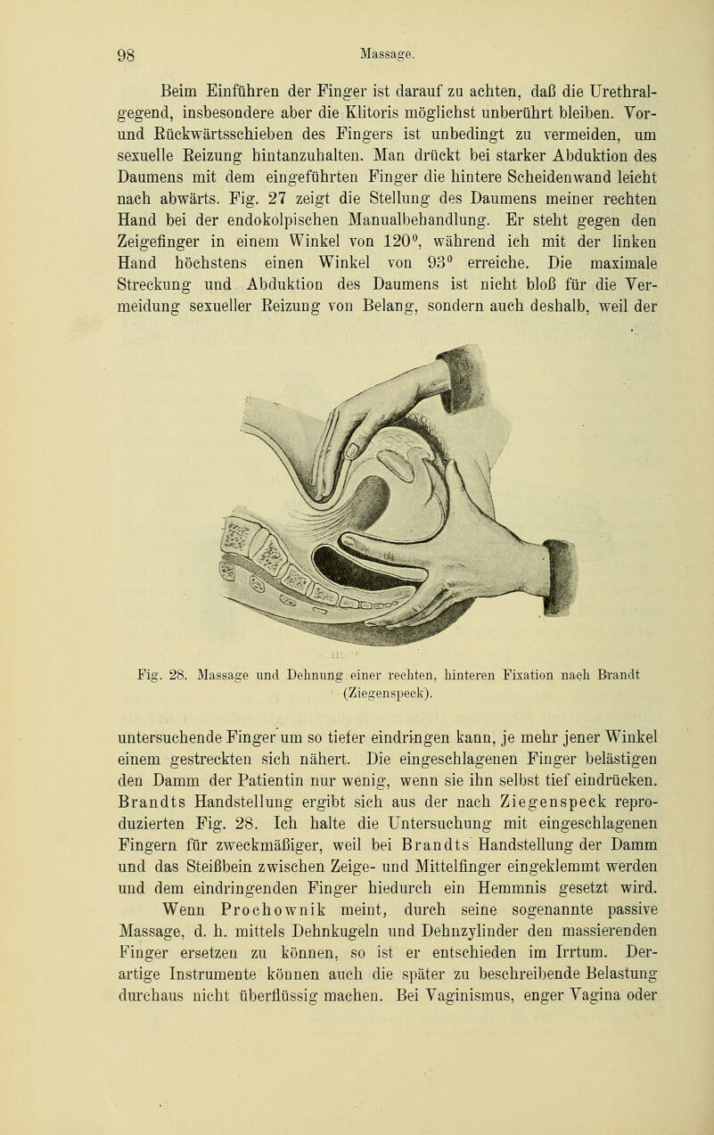 Beim Einführen der Finger ist darauf zu achten, daß die Urethral- gegend, insbesondere aber die Klitoris möglichst unberührt bleiben. Vor- und Eückwärtsschieben des Fingers ist unbedingt zu vermeiden, um sexuelle Eeizung hintanzuhalten. Man drückt bei starker Abduktion des Daumens mit dem eingeführten Finger die hintere Scheiden wand leicht nach abwärts. Fig. 27 zeigt die Stellung des Daumens meiner rechten Hand bei der endokolpisehen Manualbehandlung. Er steht gegen den Zeigefinger in einem Winkel von 120°, während ich mit der linken Hand höchstens einen Winkel von 93° erreiche. Die maximale Streckung und Abduktion des Daumens ist nicht bloß für die Ver- meidung sexueller Eeizung von Belang, sondern auch deshalb, weil der Fig. 28. Massage und Dehnung einer rechten, hinteren Fixation nach Brandt (Ziegenspeck). untersuchende Finger um so tiefer eindringen kann, je mehr jener Winkel einem gestreckten sich nähert. Die eingeschlagenen Finger belästigen den Damm der Patientin nur wenig, wenn sie ihn selbst tief eindrücken. Brandts Handstellung ergibt sich aus der nach Ziegenspeck repro- duzierten Fig. 28. Ich halte die Untersuchung mit eingeschlagenen Fingern für zweckmäßiger, weil bei Brandts Handstellung der Damm und das Steißbein zwischen Zeige- und Mittelfinger eingeklemmt werden und dem eindringenden Finger hiedurch ein Hemmnis gesetzt wird. Wenn Prochownik meint, durch seine sogenannte passive Massage, d. h. mittels Dehnkugeln und Dehnzylinder den massierenden Finger ersetzen zu können, so ist er entschieden im Irrtum. Der- artige Instrumente können auch die später zu beschreibende Belastung durchaus nicht überflüssig machen. Bei Vaginismus, enger Vagina oder