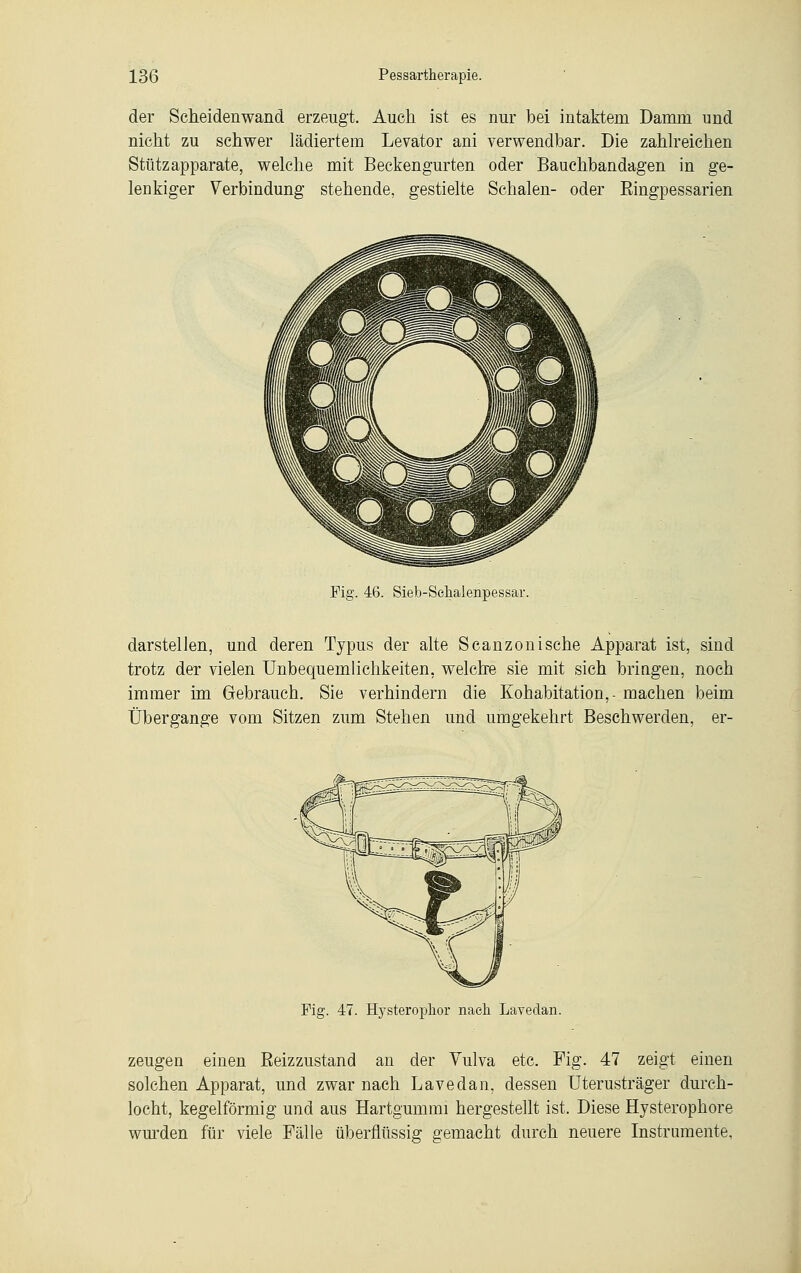 der Scheidenwand erzeugt. Auch ist es nur bei intaktem Damm und nicht zu schwer lädiertem Levator ani verwendbar. Die zahlreichen Stützapparate, welche mit Beckengurten oder Bauchbandagen in ge- lenkiger Verbindung stehende, gestielte Schalen- oder Eingpessarien Fig. 46. Sieb-Schalenpessar. darstellen, und deren Typus der alte Scanzonische Apparat ist, sind trotz der vielen Unbequemlichkeiten, welche sie mit sich bringen, noch immer im Gebrauch. Sie verhindern die Kohabitation, - machen beim Übergange vom Sitzen zum Stehen und umgekehrt Beschwerden, er- Fig. 47. Hysteroplior nach Lavedan. zeugen einen Reizzustand an der Vulva etc. Fig. 47 zeigt einen solchen Apparat, und zwar nach Lavedan, dessen Uterusträger durch- locht, kegelförmig und aus Hartgummi hergestellt ist. Diese Hysterophore wurden für viele Fälle überflüssig gemacht durch neuere Instrumente,