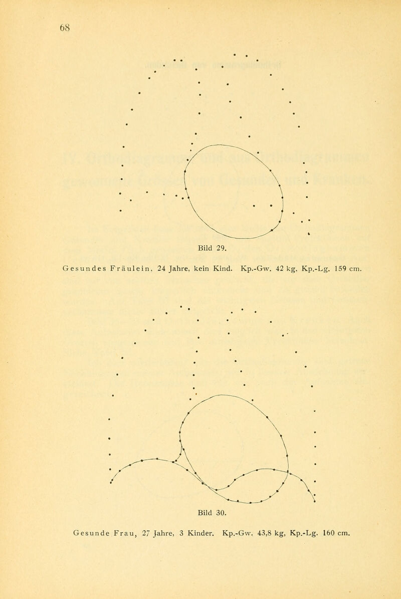 Bild 29. Gesundes Fräulein, 24 Jahre, kein Kind. Kp.-Gw. 42 kg, Kp.-Lg. 159 cm. Bild 30. Gesunde Frau, 2/ Jahre, 3 Kinder. Kp.-Gw, 43,8 kg, Kp.-Lg. 160 cm.