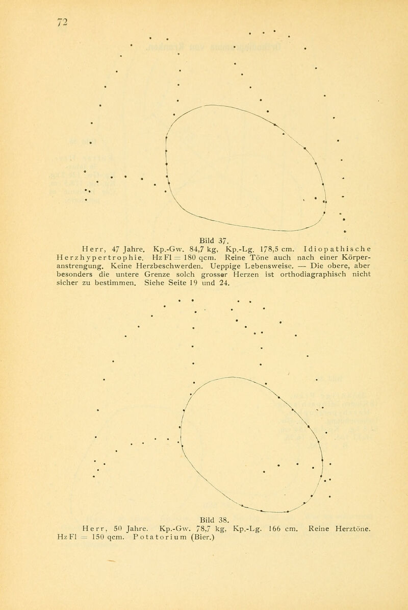 Bild 37. Herr, 47 Jahre. Kp.-Gw. 84,7 kg, Kp.-Lg. 178,5 cm. Idiopathische Herzhypertrophie. Hz Fl = 180 qcm. Reine Töne auch nach einer Körper- anstrengung. Keine Herzbeschwerden. Ueppige Lebensweise. — Die obere, aber besonders die untere Grenze solch grosser Herzen ist orthodiagraphisch nicht sicher zu bestimmen. Siehe Seite 19 und 24. Bild 38. Herr, 50 Jahre. Kp.-Gw. 78,7 kg, Kp.-Lg. Hz Fl = 150 qcm. Potatorium (Bier.) 166 cm. Reine Herztöne.