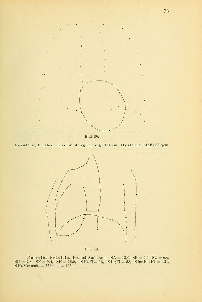 Bild 39. Fräulein, 45 Jahre. Kp.-Gw. 41kg, Kp.-Lg. 154 cm. Hysterie. HzFl 88 qcm. Bild 40. Dasselbe Fräulein. Frontal-Auf nähme. SA = 12,0, SB = 6,6, SC = 6,6, SD = 2,8, SF=9,4, SH = 13,0, S Hz Fl =63, SLgFl = 58, SInnBst Fl '= 121, S Hz Versenk. = 22°/0, o = 19°.