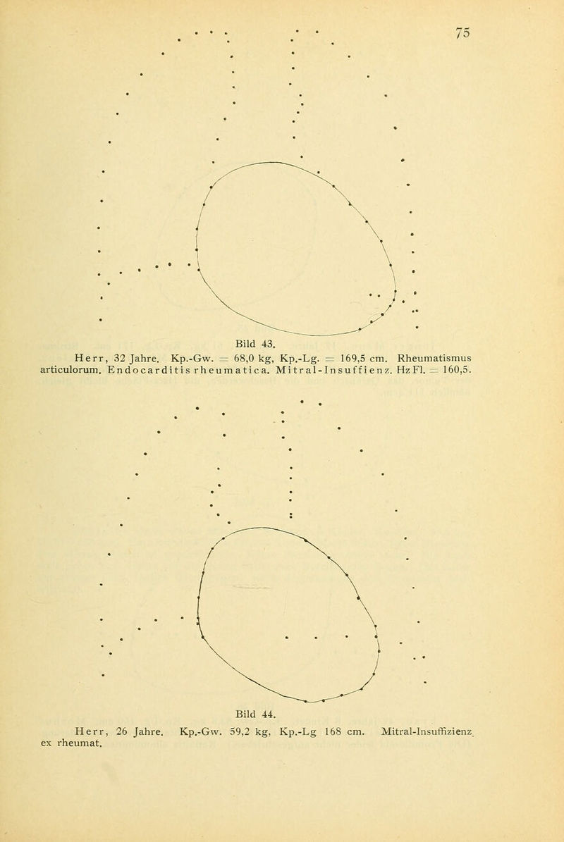 Bild 43. Herr, 32 Jahre. Kp.-Gw. = 68,0 kg, Kp.-Lg. = 169,5 cm. Rheumatismus articulorum. Endocarditisrheumatica. Mitral-Insuffienz. Hz Fl. = 160,5. Bild 44. Herr, 26 Jahre. Kp.-Gw. 59,2 kg, Kp.-Lg 168 cm. Mitralinsuffizienz. ex rheumat.