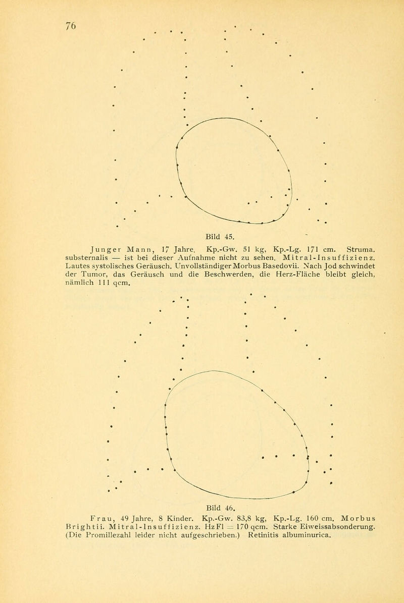 Bild 45. Junger Mann, 17 Jahre. Kp.-Gw. 51 kg, Kp.-Lg. 171 cm. Struma, substernalis — ist bei dieser Aufnahme nicht zu sehen. Mitralinsuffizienz. Lautes systolisches Geräusch. Unvollständiger Morbus Basedovii. Nach Jod schwindet der Tumor, das Geräusch und die Beschwerden, die Herz-Fläche bleibt gleich, nämlich 111 qcm. Bild 46. Frau, 49 Jahre, 8 Kinder. Kp.-Gw. 83,8 kg, Kp.-Lg. 160 cm. Morbus Brightii. Mitralinsuffizienz. HzFl = 170qcm. Starke Eiweissabsonderung. (Die Promillezahl leider nicht aufgeschrieben.) Retinitis albuminurica.