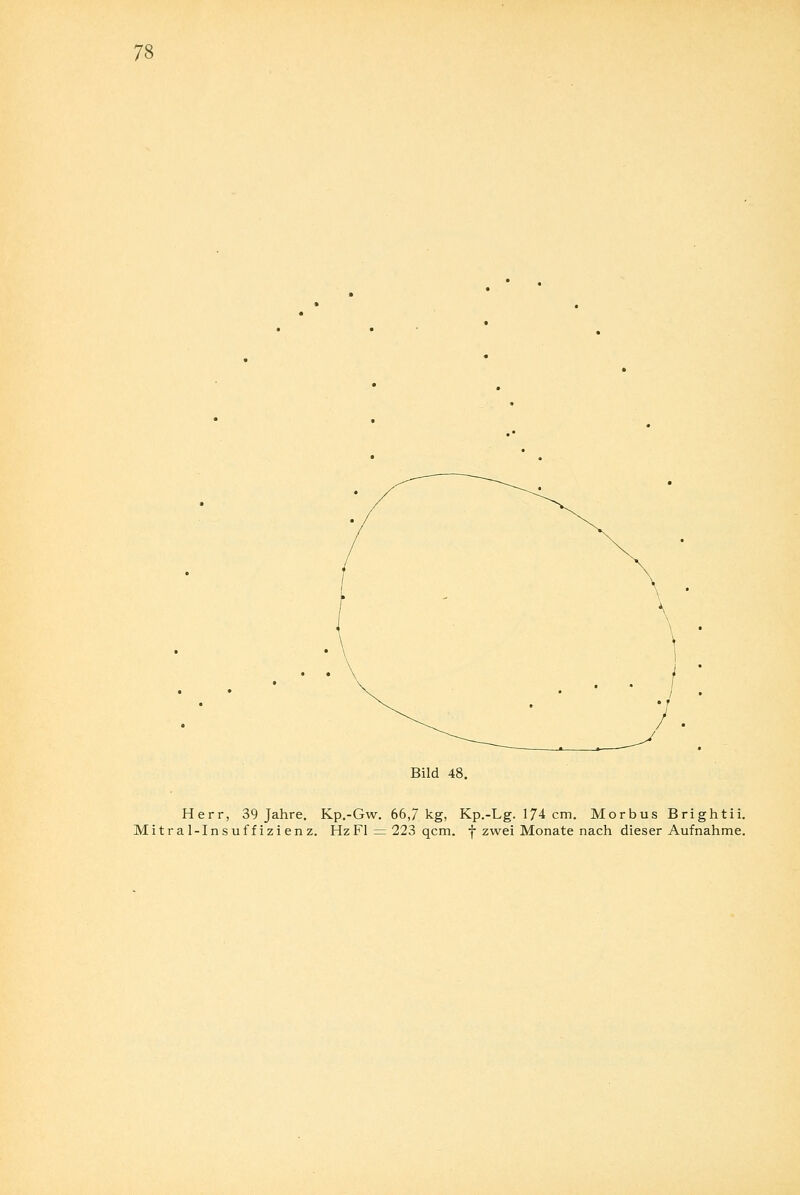 Bild 48. Herr, 39 J Mitral-Insuffizienz Jahre. Kp.-Gw. 66,/ kg, Kp.-Lg. 174 cm. Morbus Brightii. izienz. Hz Fl = 223 qcm. f zwei Monate nach dieser Aufnahme.