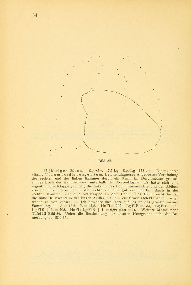 Bild 56. 65 jähriger Mann. Kp.-Gw. 47,7 kg, Kp.-Lg. 153 cm. Diagn. intra vitam: Vitium cordis congenitum. Leichendiagnose: Angeborene Verbindung der rechten und der linken Kammer durch ein 8 mm im Durchmesser grosses rundes Loch der Kammerwand unterhalb der Aortenklappe. Es hatte sich eine eigentümliche Klappe gebildet, die links in das Loch hineinreichte und den Abfluss von der linken Kammer in die rechte ziemlich gut verhinderte. Auch in der rechten Kammer war eine Art Klappe an dem Loch. Das Herz reicht bis an die linke Brustwand in der linken Axillarlinie, nur ein Stück atelektatischer Lunge trennt es von dieser. — Ich bewahre dies Herz auf; es ist das grösste meiner Sammlung. — A = 17,6, B = 12,8. HzFl = 202, LgFlR=133, Lg Fl L = 72, LgFIR -4- L = 205. Hz Fl : LgFIR -f L = 0,99 (fast = 1). Weitere Masse siehe Tafel III Bild 56. Ueber die Bestimmung der unteren Herzgrenze siehe die Be- merkung zu Bild 37.