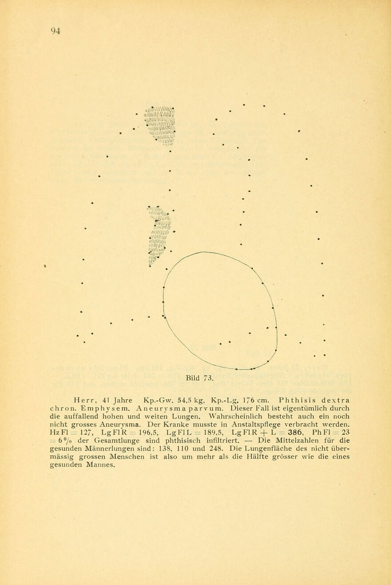 Bild 7i. Herr, 41 Jahre Kp.-Gw. 54,5 kg, Kp.-Lg. 176 cm. Phthisis dextra chron. Emphysem. Aneurysma parvum. Dieser Fall ist eigentümlich durch die auffallend hohen und weiten Lungen. Wahrscheinlich besteht auch ein noch nicht grosses Aneurysma. Der Kranke musste in Anstaltspflege verbracht werden. HzFl=127, LgFlR = 196,5, Lg F1L = 189,5, LgFlR + L = 386, PhFl = 23 = 6 °/o der Gesamtlunge sind phthisisch infiltriert. — Die Mittelzahlen für die gesunden Männerlungen sind: 138, 110 und 248. Die Lungenfläche des nicht über- mässig grossen Menschen ist also um mehr als die Hälfte grösser wie die eines gesunden Mannes.