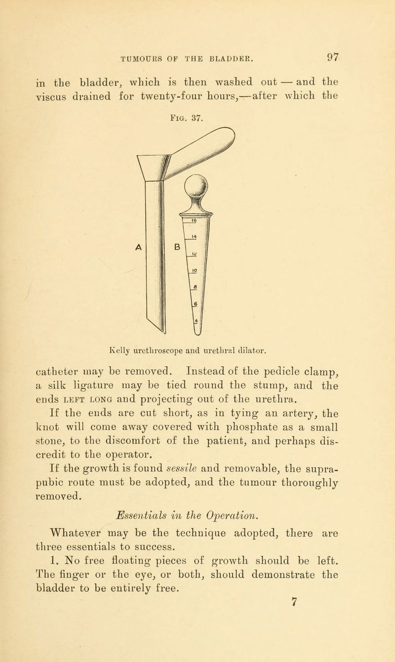 in the bladder, which is then washed out — and the viscus drained for twenty-four hours,—after which the Fig. 37. Kelly urethroscope and urethral dilator. catheter may be removed. Instead of the pedicle clamp, a silk ligature may be tied round the stump, and the ends left long and projecting out of the urethra. If the ends are cut short, as in tying an artery, the knot will come away covered with phosphate as a small stone, to the discomfort of the patient, and perhaps dis- credit to the operator. If the growth is found sessile and. removable, the supra- pubic route must be adopted, and the tumour thoroughly removed. Essentials in the Operation. Whatever may be the technique adopted, there are three essentials to success. 1. No free floating pieces of growth should be left. The finger or the eye, or both, should demonstrate the bladder to be entirelv free.