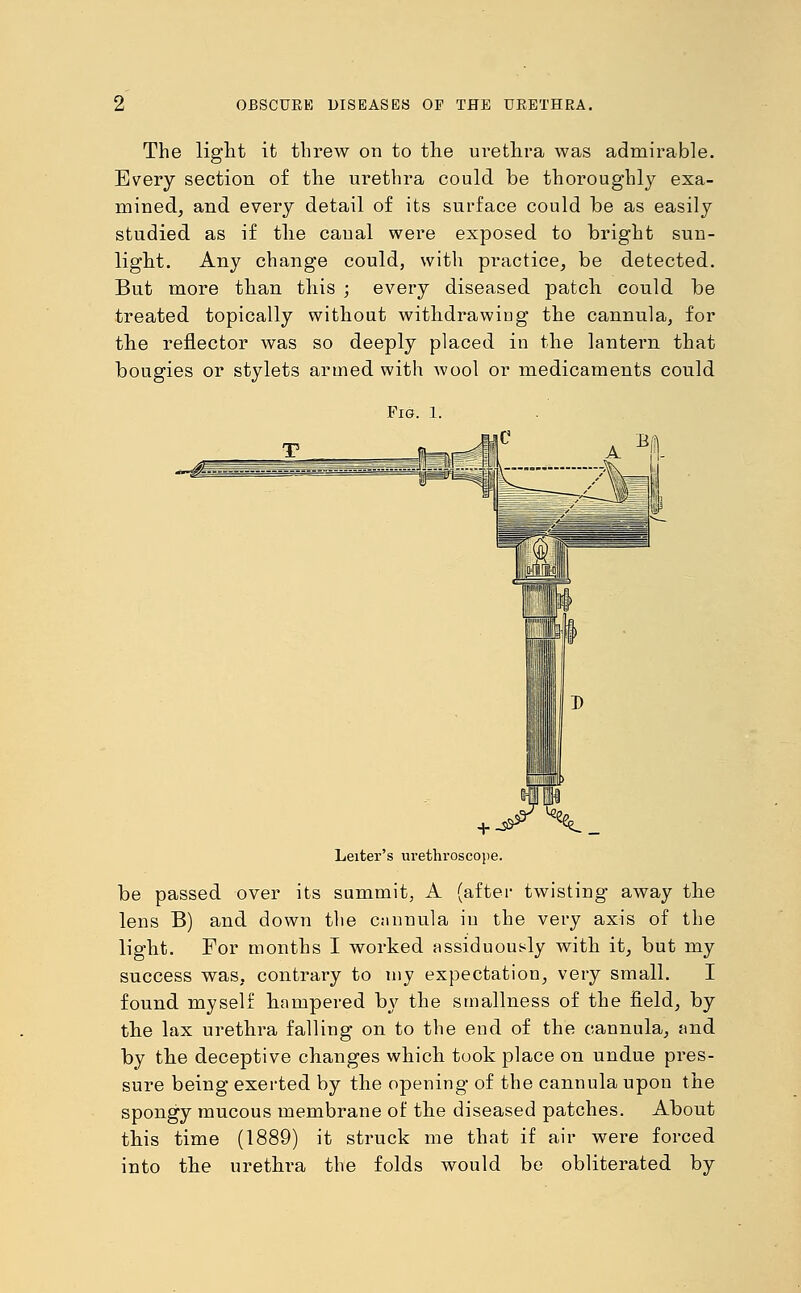 The light it threw on to the urethra was admirable. Every section of the urethra could be thoroughly exa- mined, and every detail of its surface could be as easily studied as if tlie canal were exposed to bright sun- light. Any change could, with practice, be detected. But more than this ; every diseased patch could be treated topically without withdrawiug the cannula, for the reflector was so deeply placed in the lantern that bougies or stylets armed with wool or medicaments could FlGt. l. Leiter's urethroscope. be passed over its summit, A (after twisting away the lens B) and down the cannula in the very axis of the light. For months I worked assiduously with it, but my success was, contrary to my expectation, very small. I found myself hampered by the smallness of the field, by the lax urethra falling on to the eud of the cannula, and by the deceptive changes which took place on undue pres- sure being exerted by the opening of the cannula upon the spongy mucous membrane of the diseased patches. About this time (1889) it struck me that if air were forced into the urethra the folds would be obliterated by