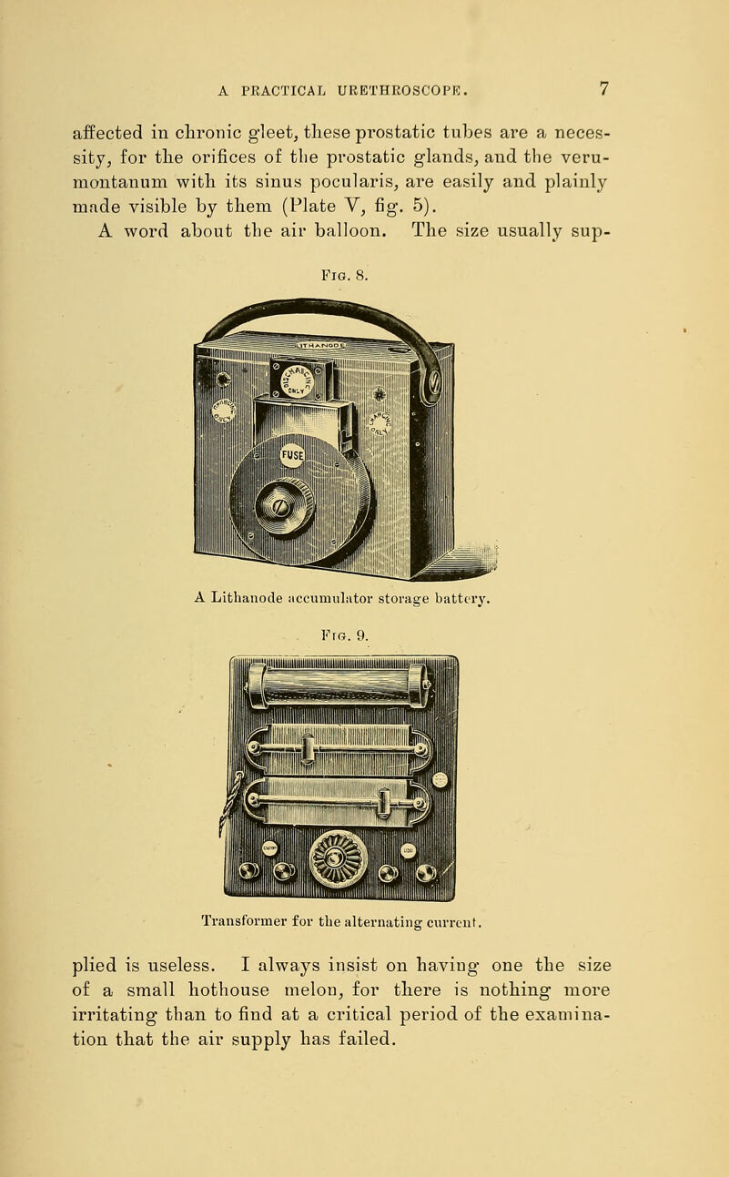 affected in chronic gleet, these prostatic tubes are a neces- sity, for the orifices of the prostatic glands, and the veru- montanum with its sinus pocularis, are easily and plainly made visible by them (Plate Y, fig. 5). A word about the air balloon. The size usually sup- Fig. 8. A Lithanode accumulator storage battery. Fro. 9. Transformer for the alternating current. plied is useless. I always insist on having one the size of a small hothouse melon, for there is nothing more irritating than to find at a critical period of the examina- tion that the air supply has failed.