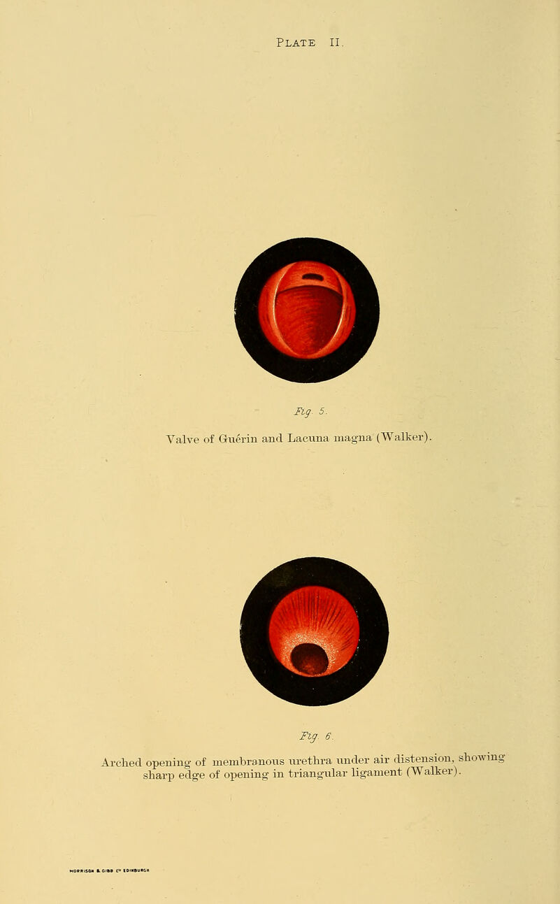 Fig. 5. Valve of Gruerin and Lacuna magna (Walker). Fig. 6. Arched opening of membranous urethra under air distension, showing sharp edge of opening in triangular ligament (Walker).