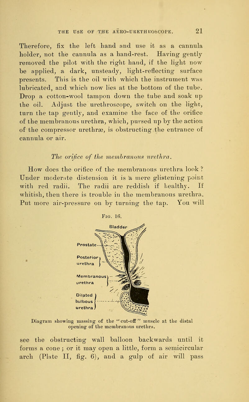 Therefore, fix the ]eft hand and use it as a cannula holdei-, not the caunula as a hand-rest. Having gently removed the pilot with the rig-ht hand, if the liglit now be applied, a dark, unsteady, light-reflecting surface presents. This is the oil with which tlie instrument was lubricated, and which now lies at the bottom of the tube. Drop a cotton-wool tampon down the tube and soak up the oil. Adjust the urethroscope, switch on the light, turn the tap gently, and examine the face of the orifice of the membranous urethra, which, pursed up by the action of the compressor urethras, is obstructing the entrance of cannula or air. The orifice of the membranous urethra. How does the orifice of the membranous urethra look ? Under moderate distension it is a mere glistening point with red radii. The radii are reddish if healthy. If whitish, then there is trouble in the membranous urethra. Put more air-pressure on by turning the tap. You will Diagram showing massing of the cut-off muscle at the distal opening of the membranous urethra. see the obstructing wall balloon backwards until it forms a cone ; or it may open a little, form a semicircular arch (Plate II, fig. 6), and a gulp of air will pass