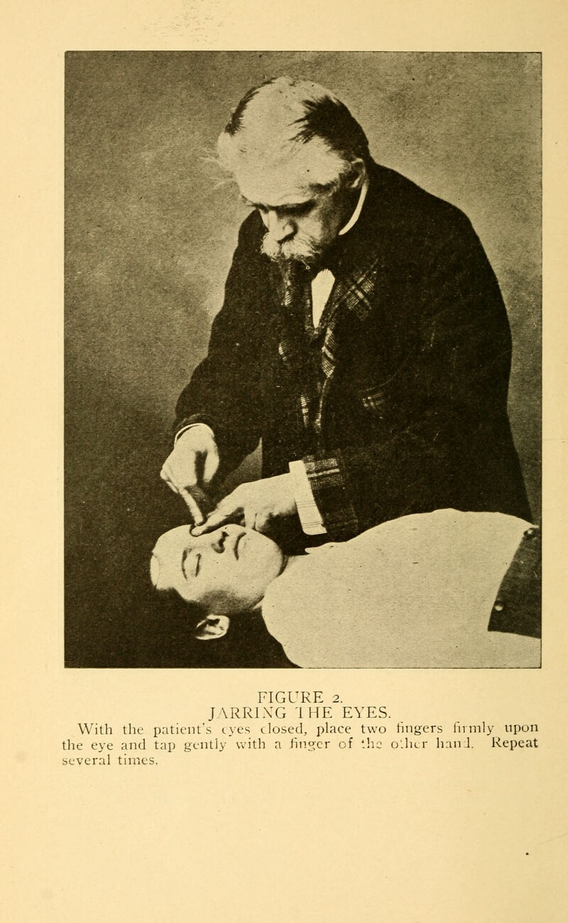 JARRING 'IKE EYES. With the patient's eyes closed, place two fingers firmly upon the eye and tap gently with a finger of the oilier hand. Repeat several times.