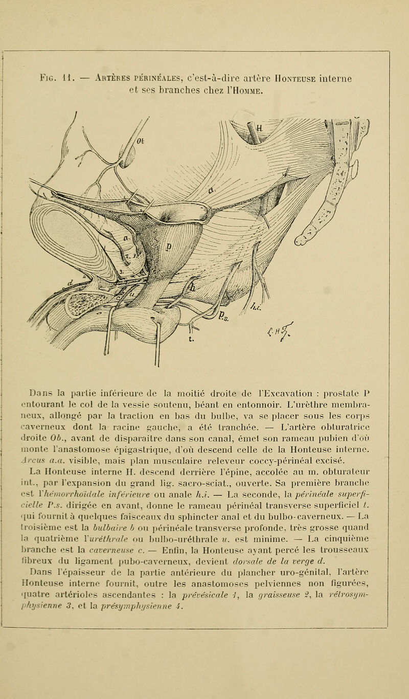 Fio. 11. — Artères périnéales, c'est-à-dire artère Honteuse interne et ses branches chez I'Homme. Dans la partie inférieure de la moitié droite de l'Excavation : prostate P entourant le col de la vessie soutenu, béant en entonnoir. L'urèthre membra- neux, allongé par la traction en bas du bulbe, va se placer sous les corps caverneux dont la racine gauche, a été tranchée. — L'artère obturatrice droite 01)., avant de disparaître dans son canal, émet son rameau pubien d'où monte l'anastomose épigastrique, d'où descend celle de la Honteuse interne. A rcus a.a. visible, mais plan musculaire releveur coccy-périnéal excisé. La Honteuse interne H. descend derrière l'épine, accolée au m. obturateur int.. par l'expansion du grand lig. sacro-sciat., ouverte. Sa première branche est Vhémorrhoïdale inférieure ou anale h.i. — La seconde, la périnéale superfi- cielle P.s. dirigée en avant, donne le rameau périnéal transverse superficiel t. ■ lui fournit à quelques faisceaux du sphincter anal et du bulbo-caverneux. — La troisième est la bulbaire b ou périnéale transverse profonde, très grosse quand la quatrième Yuréthrale ou bulbo-uréthrale u. est minime. — La cinquième branche est la caverneuse c. — Enfin, la Honteuse avant percé les trousseaux fibreux du ligament pubo-caverneux, devient dorsale de la verge d. Dans l'épaisseur de la partie antérieure du plancher uro-génital, l'artère Honteuse interne fournit, outre les anastomoses pelviennes non figurées, quatre artérioles ascendantes : la prévésicale -/, la graisseuse 2, la rétrosym- l'hysienne 3, et la présymphysienne i.