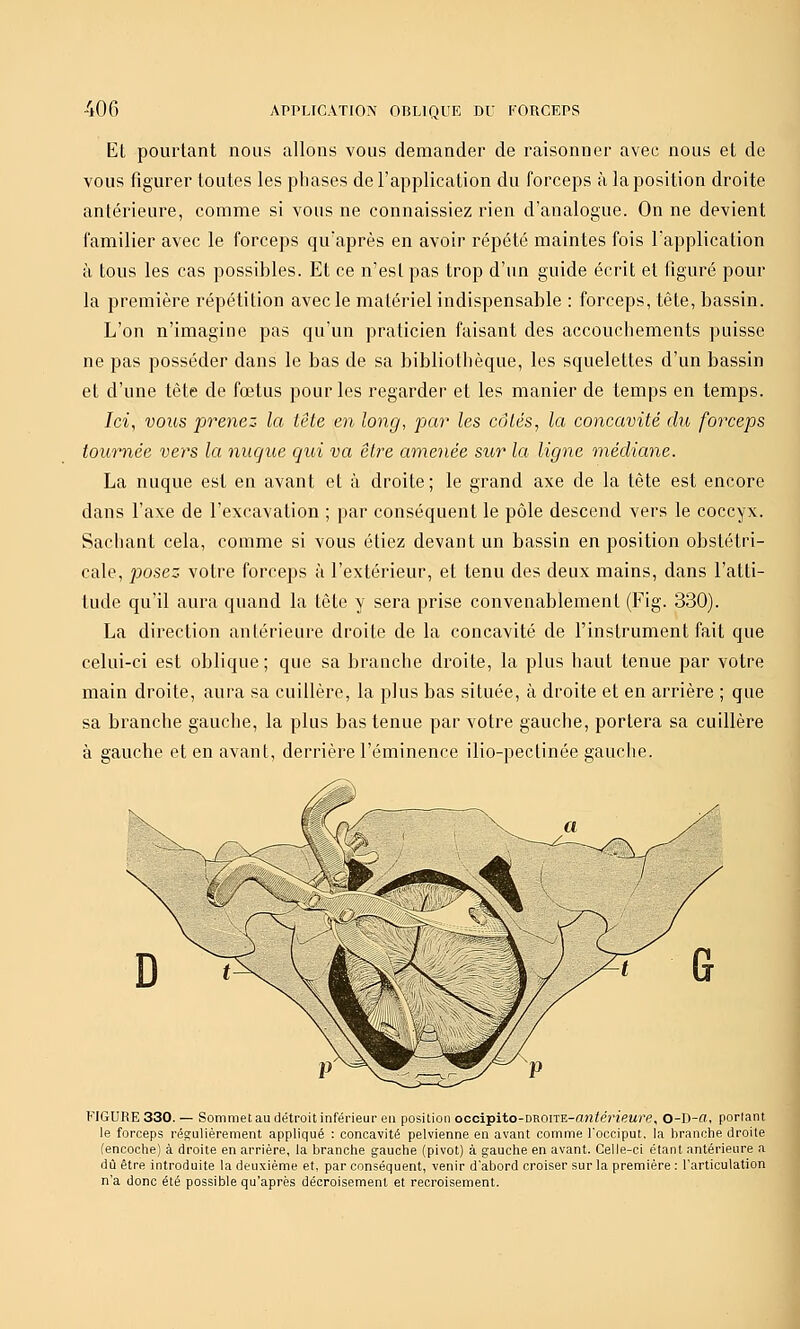 Et pourtant nous allons vous demander de raisonner avec nous et de vous figurer toutes les phases de l'application du forceps à la position droite antérieure, comme si vous ne connaissiez rien d'analogue. On ne devient familier avec le forceps qu'après en avoir répété maintes fois l'application à tous les cas possibles. Et ce n'esl pas trop d'un guide écrit et figuré pour la première répétition avec le matériel indispensable : forceps, tête, bassin. L'on n'imagine pas qu'un praticien faisant des accouchements puisse ne pas posséder dans le bas de sa bibliothèque, les squelettes d'un bassin et d'une tête de fœtus pour les regarder et les manier de temps en temps. Ici, vous prenez la tête en long, par les côtés, la concavité du forceps tournée vers la nuque qui va être amenée sur la ligne médiane. La nuque est en avant et à droite; le grand axe de la tête est encore dans l'axe de l'excavation ; par conséquent le pôle descend vers le coccyx. Sachant cela, comme si vous étiez devant un bassin en position obstétri- cale, posez votre forceps à l'extérieur, et tenu des deux mains, dans l'atti- tude qu'il aura quand la tête y sera prise convenablement (Fig. 330). La direction antérieure droite de la concavité de l'instrument fait que celui-ci est oblique; que sa branche droite, la plus haut tenue par votre main droite, aura sa cuillère, la plus bas située, à droite et en arrière ; que sa branche gauche, la plus bas tenue par votre gauche, portera sa cuillère à gauche et en avant, derrière l'éminence ilio-pectinée gauche. FIGURE 330. — Sommet au détroit inférieur en position occipito-DROiTE-aji/e'î'ieMre, O-D-ffl, porlant le forceps régulièrement appliqué : concavité pelvienne en avant comme l'occiput, la branche droite (encoche) à droite en arrière, la branche gauche (pivot) à gauche en avant. Celle-ci étant antérieure a dû être introduite la deuxième et, par conséquent, venir d'abord croiser sur la première : l'articulation n'a donc été possible qu'après décroisement et recroisement.