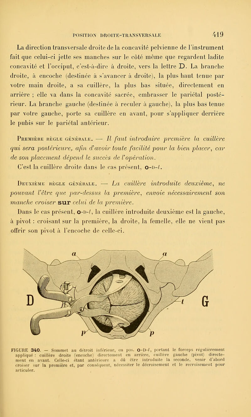 La direction transversale droite de la concavité pelvienne de l'instrument fait que celui-ci jette ses manches sur le côté même que regardent ladite concavité et l'occiput, c'est-à-dire à droite, vers la lettre D. La branche droite, à encoche (destinée à s'avancer à droite), la plus haut tenue par votre main droite, a sa cuillère, la plus bas située, directement en arrière ; elle va dans la concavité sacrée, embrasser le pariétal posté- rieur. La branche gauche (destinée à reculer à gauche), la plus bas tenue par votre gauche, porte sa cuillère en avant, pour s'appliquer derrière le pubis sur le pariétal antérieur. Première règle générale. — Il faut introduire première la cuillère qui sera postérieure, afin d'avoir toute facilité pour la bien placer, car de son placement dépend le succès de ropération. C'est la cuillère droite dans le cas présent, o-d-/. Deuxième règle générale. — La cuillère introduite deuxième, ne pouvant l'être que par-dessus la première, envoie nécessairement son manche croiser sur celui de la preinière. Dans le cas présent, o-d-/, la cuillère introduite deuxième est la gauche, à pivot : croisant sur la première, la droite, la femelle, elle ne vient pas offrir son pivot à l'encoche de celle-ci. FIGURE 340. — Sornmel au diHroil iiilùrieui', un pos. O-U-/, portant le foi-ceps régulièrement appliqué : cuillère droite (encoche) directement en arrière, cuillère gauche (pivot) directe- ment en avant. Celle-ci étant antérieui'e a dû être introduite la seconde, venir d'abord croiser sur la première et, par conséi|uent, nécessiter le décroisement et le recroisement pour articuler. I