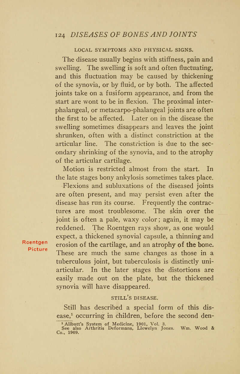 LOCAL SYMPTOMS AND PHYSICAL SIGNS. The disease usually begins with stiffness, pain and swelling. The swelling is soft and often fluctuating, and this fluctuation may be caused by thickening of the synovia, or by fluid, or by both. The affected joints take on a fusiform appearance, and from the start are wont to be in flexion. The proximal inter- phalangeal, or metacarpo-phalangeal joints are often the first to be affected. Later on in the disease the swelling sometimes disappears and leaves the joint shrunken, often with a distinct constriction at the articular line. The constriction is due to the sec- ondary shrinking of the synovia, and to the atrophy of the articular cartilage. Motion is restricted almost from the start. In the late stages bony ankylosis sometimes takes place. Flexions and subluxations of the diseased joints are often present, and may persist even after the disease has run its course. Frequently the contrac- tures are most troublesome. The skin over the joint is often a pale, waxy color; again, it may be reddened. The Roentgen rays show, as one would expect, a thickened synovial capsule, a thinning and erosion of the cartilage, and an atrophy of the bone. These are much the same changes as those in a tuberculous joint, but tuberculosis is distinctly uni- articular. In the later stages the distortions are easily made out on the plate, but the thickened synovia will have disappeared. STILL'S DISEASE. Still has described a special form of this dis- ease,1 occurring in children, before the second den- iAllbutt's System of Medicine, 1901, Vol. 3. See also Arthritis Deformans, Llewelyn Jones. Wm. Wood & Co., 1909.
