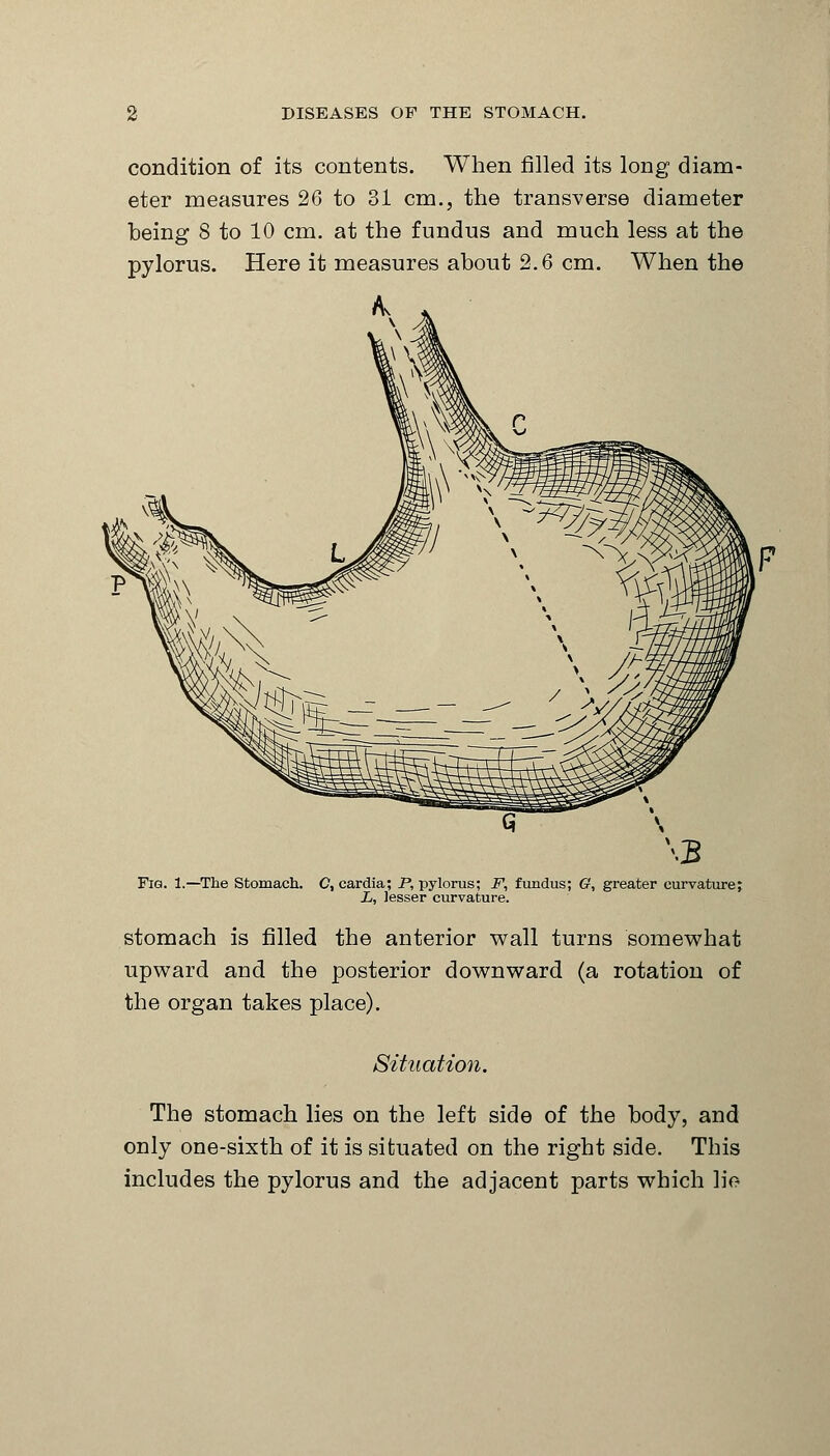 condition of its contents. When filled its long diam- eter measures 26 to 31 cm., the transverse diameter being 8 to 10 cm. at the fundus and much less at the pylorus. Here it measures about 2.6 cm. When the Fig. 1.—The Stomach. C, cardia; P, pylorus; F, fundus; G, greater curvature; L, lesser curvature. stomach is filled the anterior wall turns somewhat upward and the posterior downward (a rotation of the organ takes place). Situation. The stomach lies on the left side of the body, and only one-sixth of it is situated on the right side. This includes the pylorus and the adjacent parts which lie