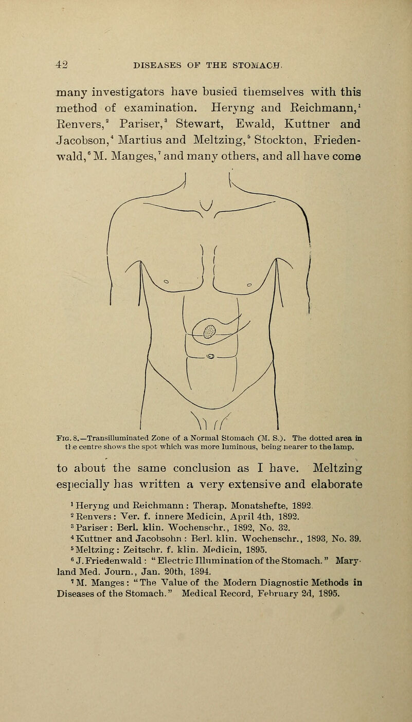 many investigators have busied themselves with this method of examination. Heryng and Reichmann,1 Renvers,2 Pariser,3 Stewart, Ewald, Kuttner and Jacobson,4 Martius and Meltzing/Stockton, Frieden- wald,6M. Manges,7 and many others, and all have come Tig. 8.— Transilluminated Zone of a Normal Stomach (M. S.). The dotted area in the centre shows the spot which was more luminous, being nearer to the lamp. to about the same conclusion as I have. Meltzing especially has written a very extensive and elaborate 1 Heryng und Reichmann : Therap. Monatshefte, 1892. 2 Renvers: Ver. f. innere Medicin, April 4th, 1892. 3 Pariser: Berl. klin. Wochenschr., 1892, No. 32. 4Kuttner and Jacobsohn : Berl. klin. Wochenschr., 1893, No. 39. 5Meltzing: Zeitschr. f. klin. Medicin, 1895. 6 J.Friedenwald : Electric Illumination of the Stomach. Mary- land Med. Journ., Jan. 20th, 1894. 7M. Manges: The Value of the Modern Diagnostic Methods in Diseases of the Stomach. Medical Record, February 2d, 1895.