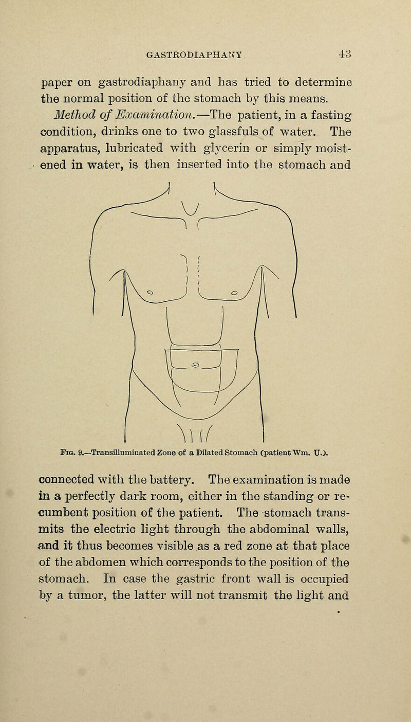 paper on gastrodiaphany and has tried to determine the normal position of the stomach by this means. Method of Examination.—The patient, in a fastiDg condition, drinks one to two glassfuls of water. The apparatus, lubricated with glycerin or simply moist- ened in water, is then inserted into the stomach and Fig. 9.—Transilluminated Zone of a Dilated Stomach (patient Wm. U J. connected with the battery. The examination is made in a perfectly dark room, either in the standing or re- cumbent position of the patient. The stomach trans- mits the electric light through the abdominal walls, and it thus becomes visible as a red zone at that place of the abdomen which corresponds to the position of the stomach. In case the gastric front wall is occupied by a tumor, the latter will not transmit the light and