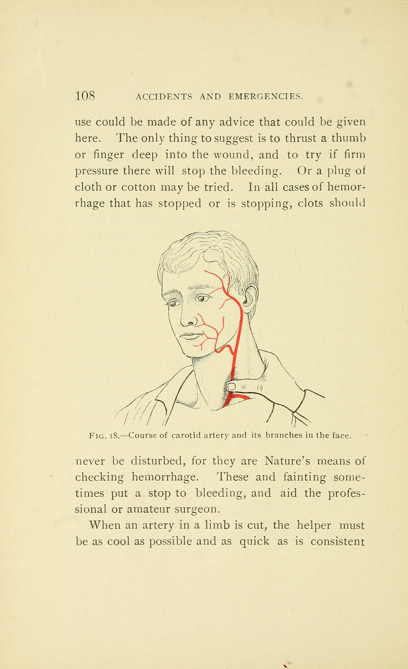 use could be made of any advice that could be given here. The only thing to suggest is to thrust a thumb or finger deep into the wound, and to try if firm pressure there will stop the bleeding. Or a plug of cloth or cotton may be tried. In all cases of hemor- rhage that has stopped or is stopping, clots should Fig. iS.—Course of carotid artery and its branches in the face. never be disturbed, for they are Nature's means of checking hemorrhage. These and fainting some- times put a stop to bleeding, and aid the profes- sional or amateur surgeon. When an artery in a limb is cut, the helper must be as cool as possible and as quick as is consistent