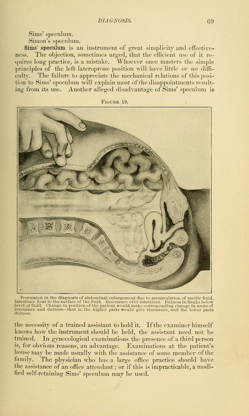 Sims' speculum. Simon's speculum. Sims' speculum is an instrument of great simplicity and effective- ness. The objection, sometimes urged, that the efficient use of it re- quires long practice, is a mistake. Whoever once masters the simple principles of the left lateroprone position will have little or no diffi- culty. The failure to appreciate the mechanical relations of this posi- tion to Sims' speculum will explain most of the disappointments result- ing from its use. Another alleged disadvantage of Sims' speculum is FlGUKE 19. Percussion in the diagnosis of abdominal enlargement due to accumulation of ascitic fluid. Intestines float to the surface of the fluid. Resonance over intestines. Dulness in flanks below level of fluid. Change in position of the patient would make corresponding change in areas of resonance and dulness—that is, the higher parts would give resonance, and the lower parts dulness. the necessity of a trained assistant to hold it. If the examiner himself knows how the instrument should be held, the assistant need not be trained. In gynecological examinations the presence of a third person is, for obvious reasons, an advantage. Examinations at the patient's house may be made usually with the assistance of some member of the family. The physician who has a large office practice should have the assistance of an office attendant; or if this is impracticable, a modi- fied self-retaining Sims' speculum may be used.